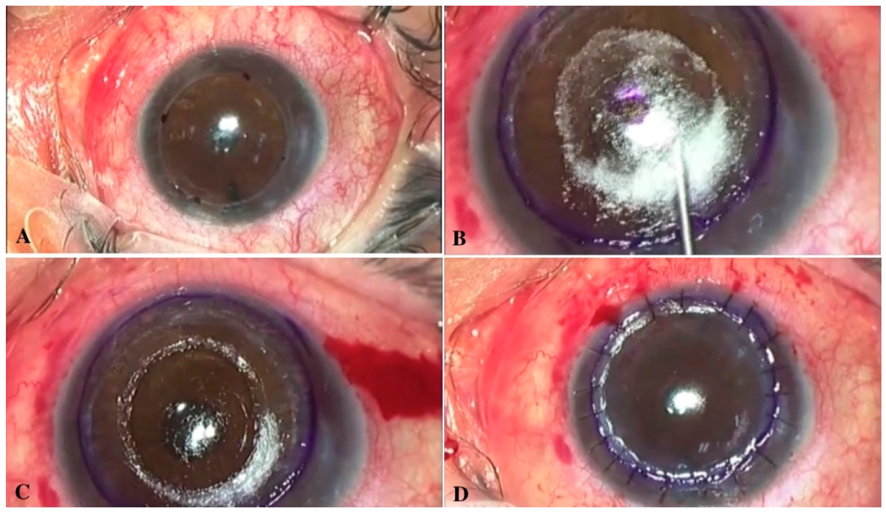 Jcm 11 02678 g006 550