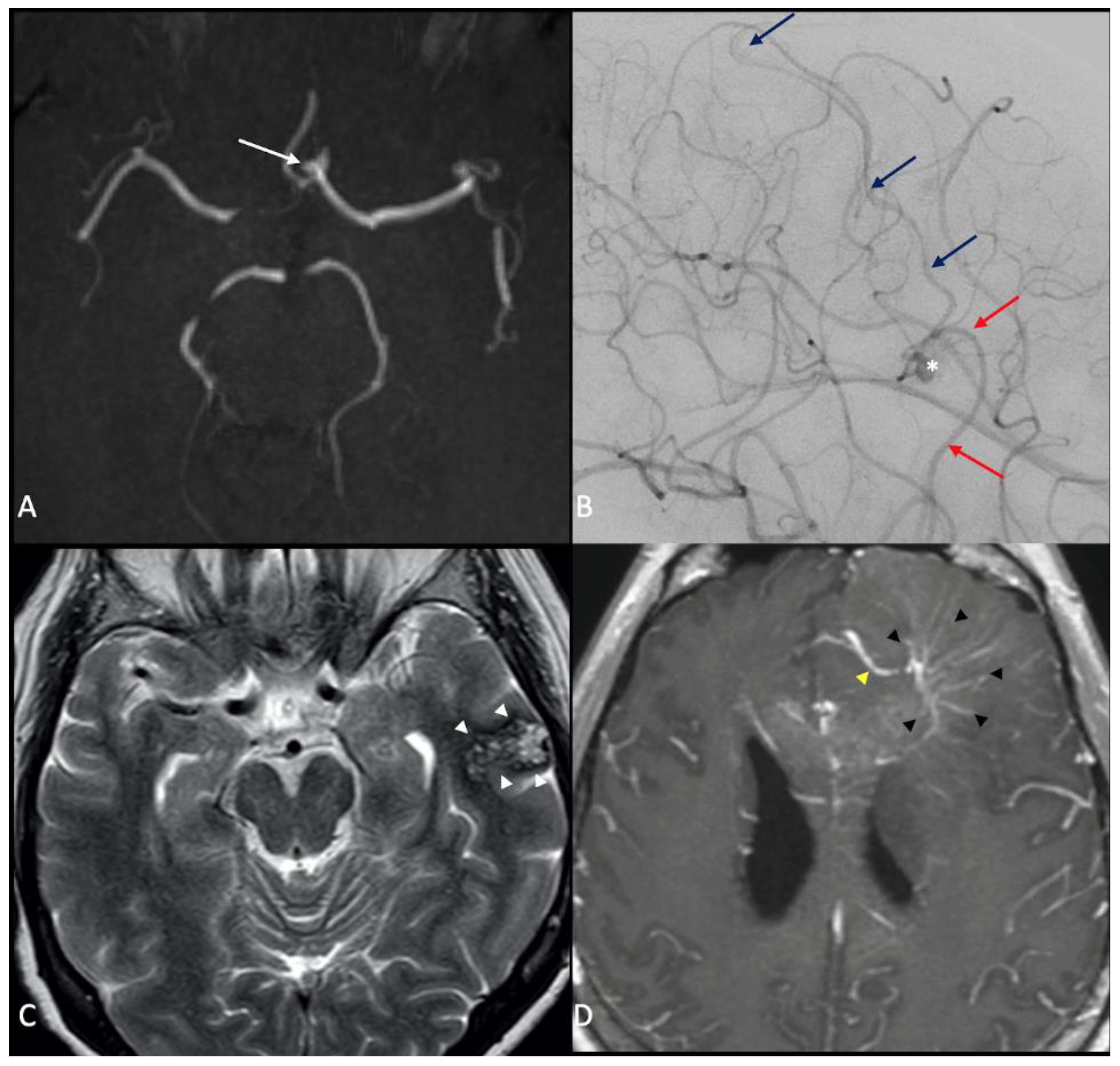 Jcm 11 02685 g002 550