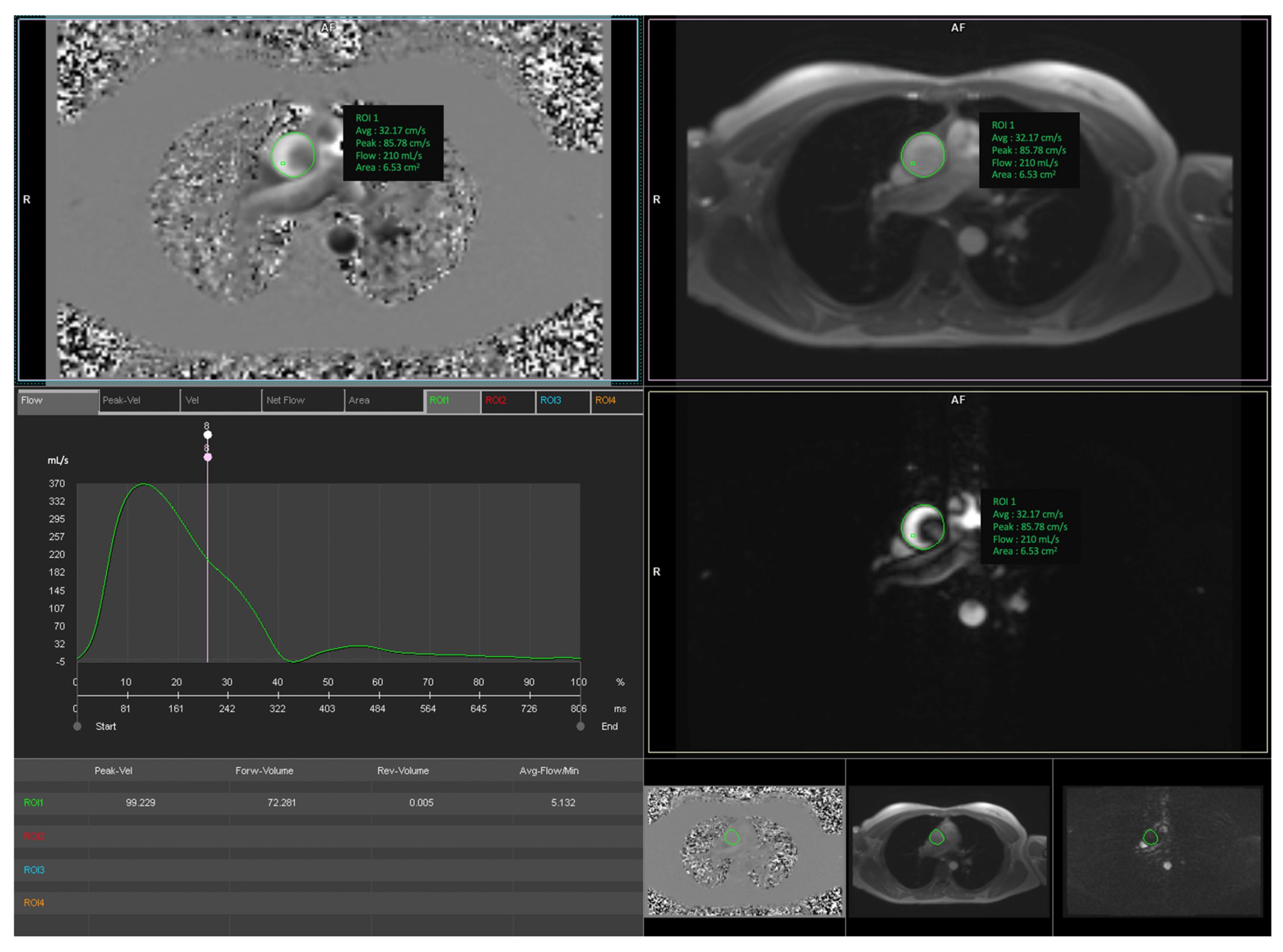 Jcm 11 02717 g002b 550