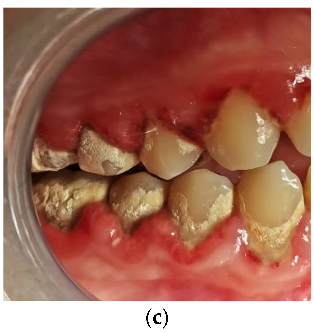 Jcm 11 02758 g001b 550