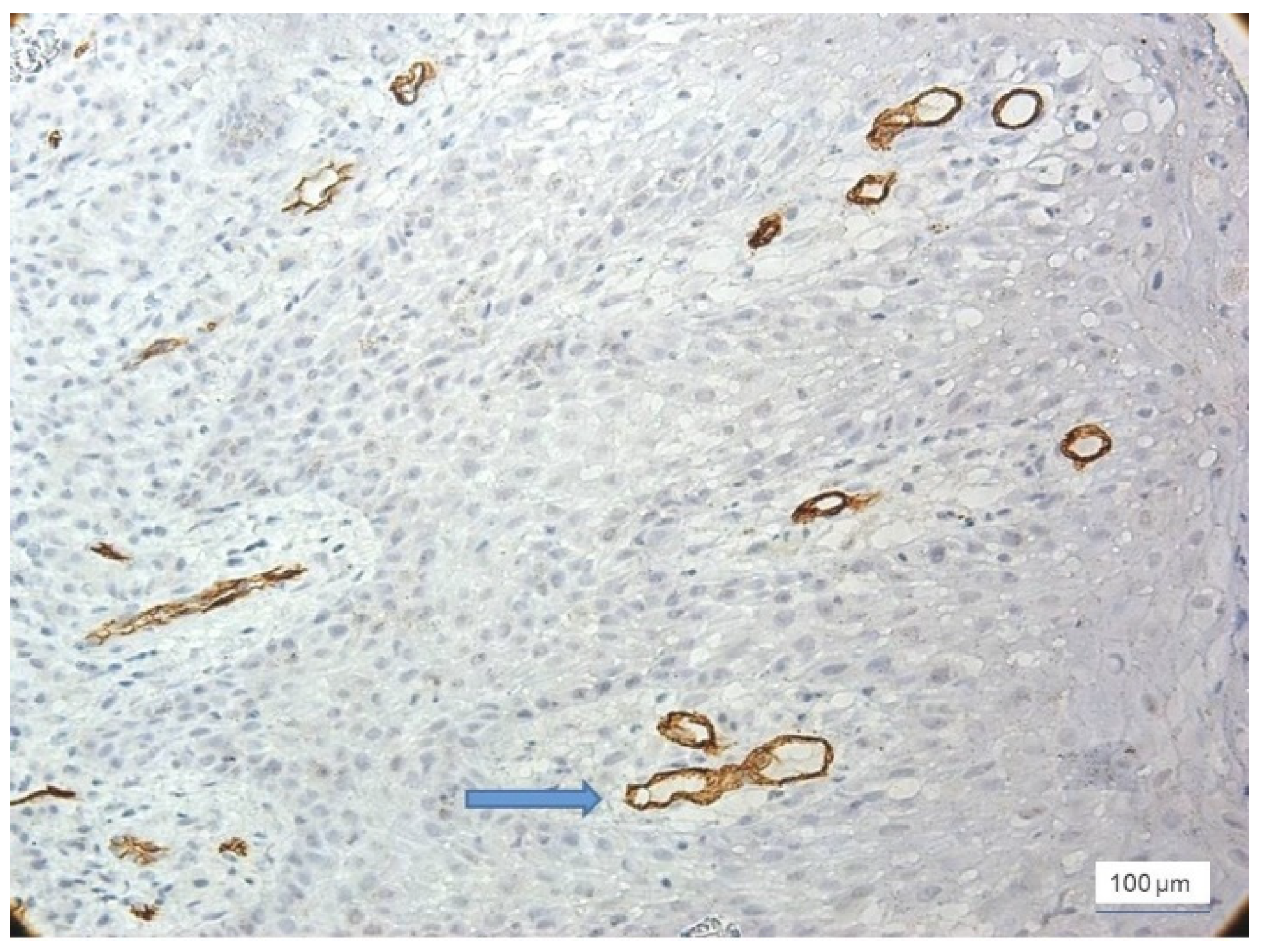 Jcm 11 02758 g005 550