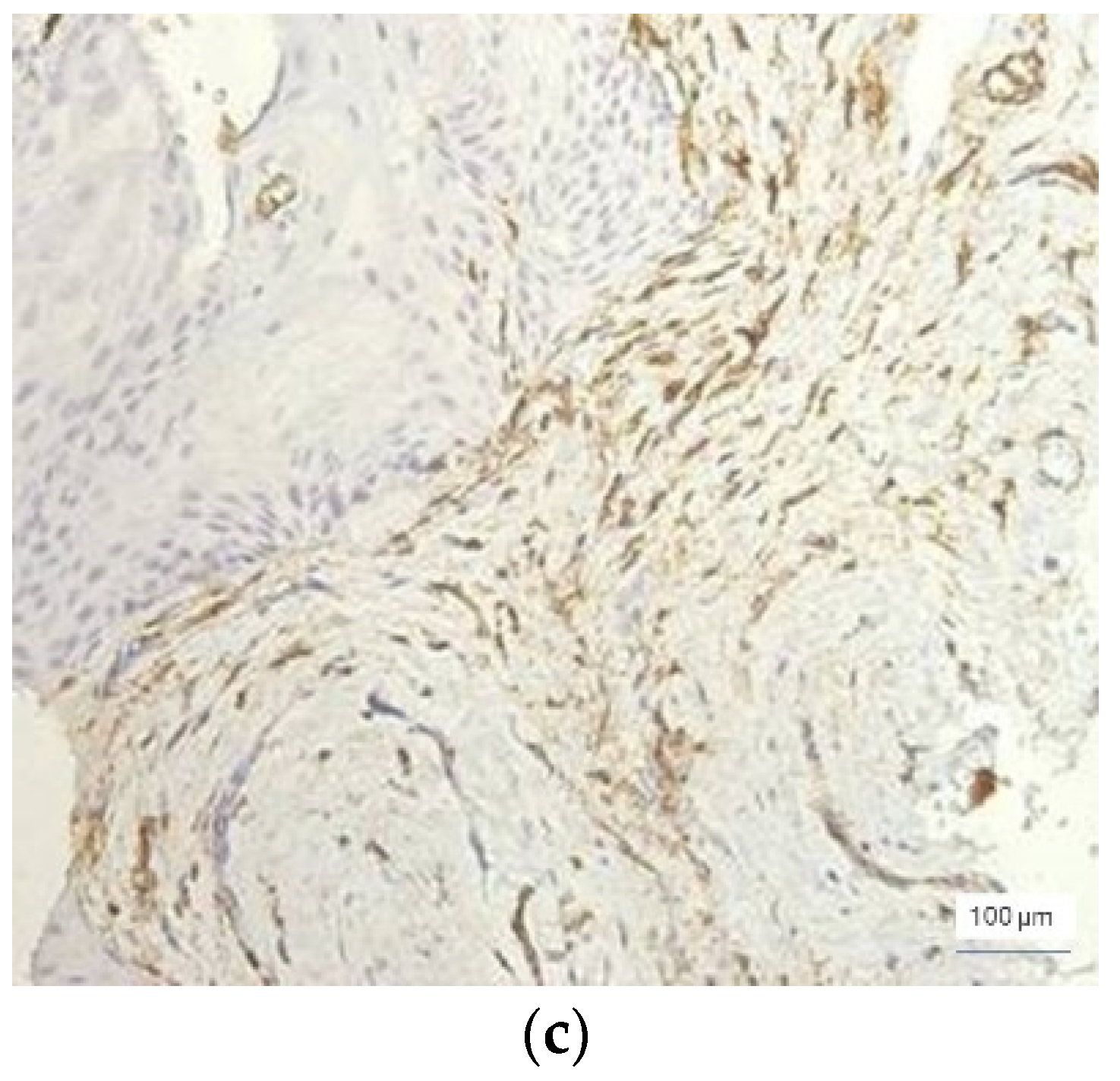 Jcm 11 02758 g008b 550