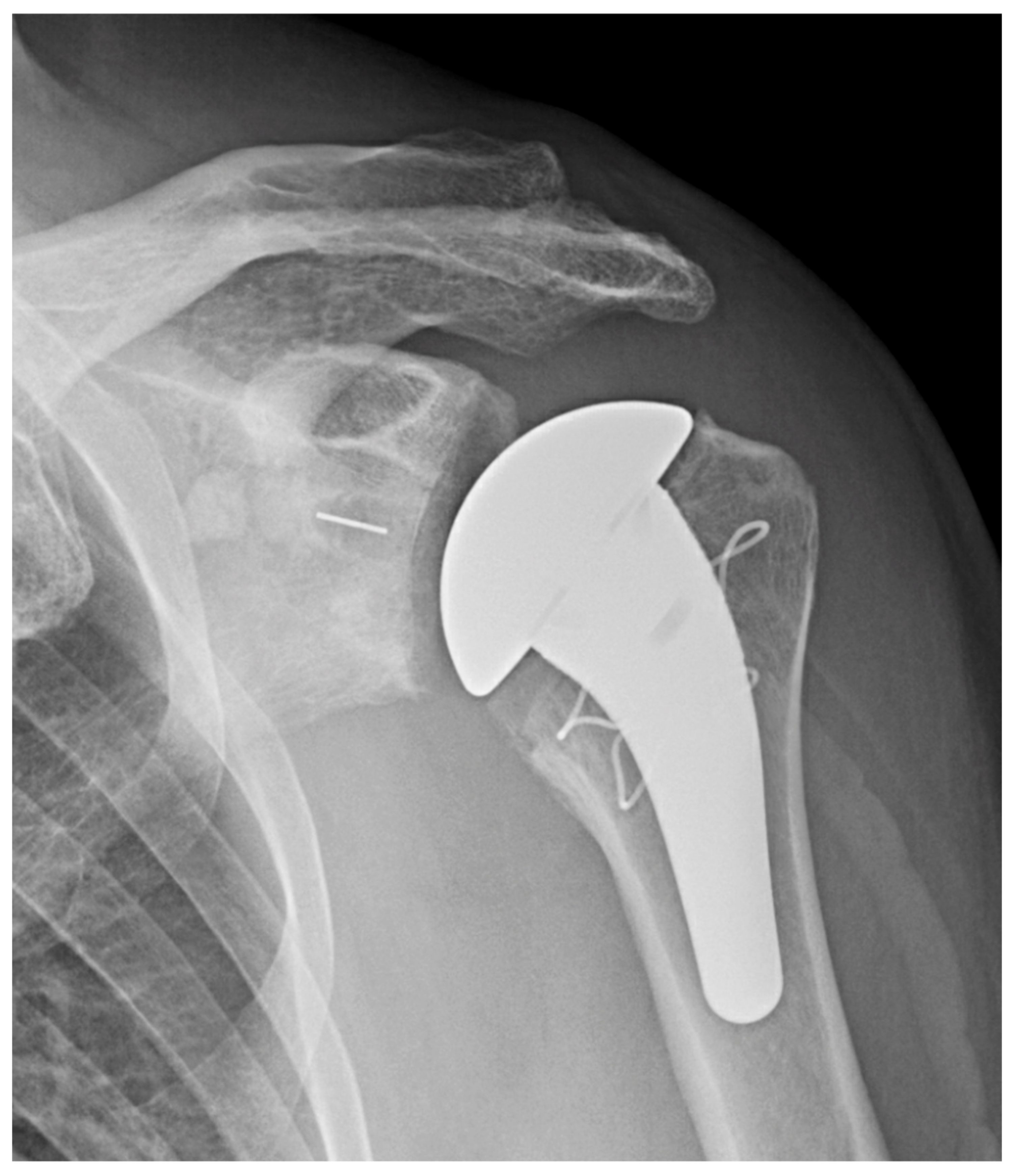 Jcm 11 02799 g002 Jcm 11 02799 g002