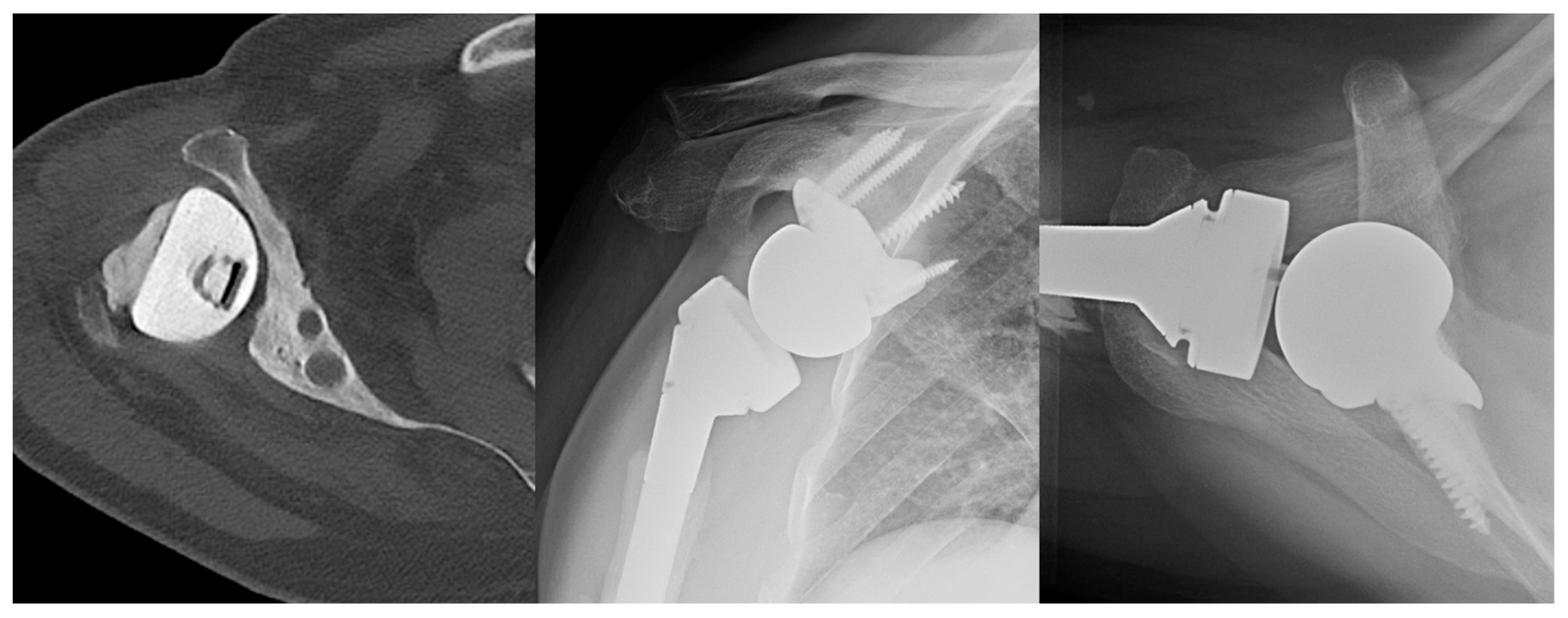 Jcm 11 02799 g007 Jcm 11 02799 g007