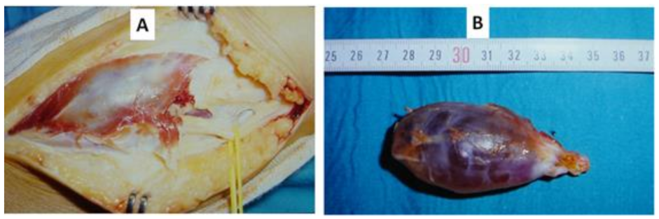 Jcm 11 02804 g002 Jcm 11 02804 g002