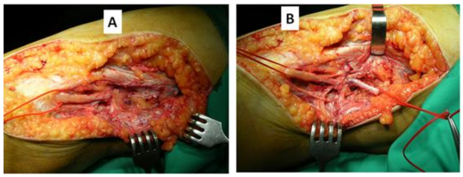 Jcm 11 02804 g003 Jcm 11 02804 g003