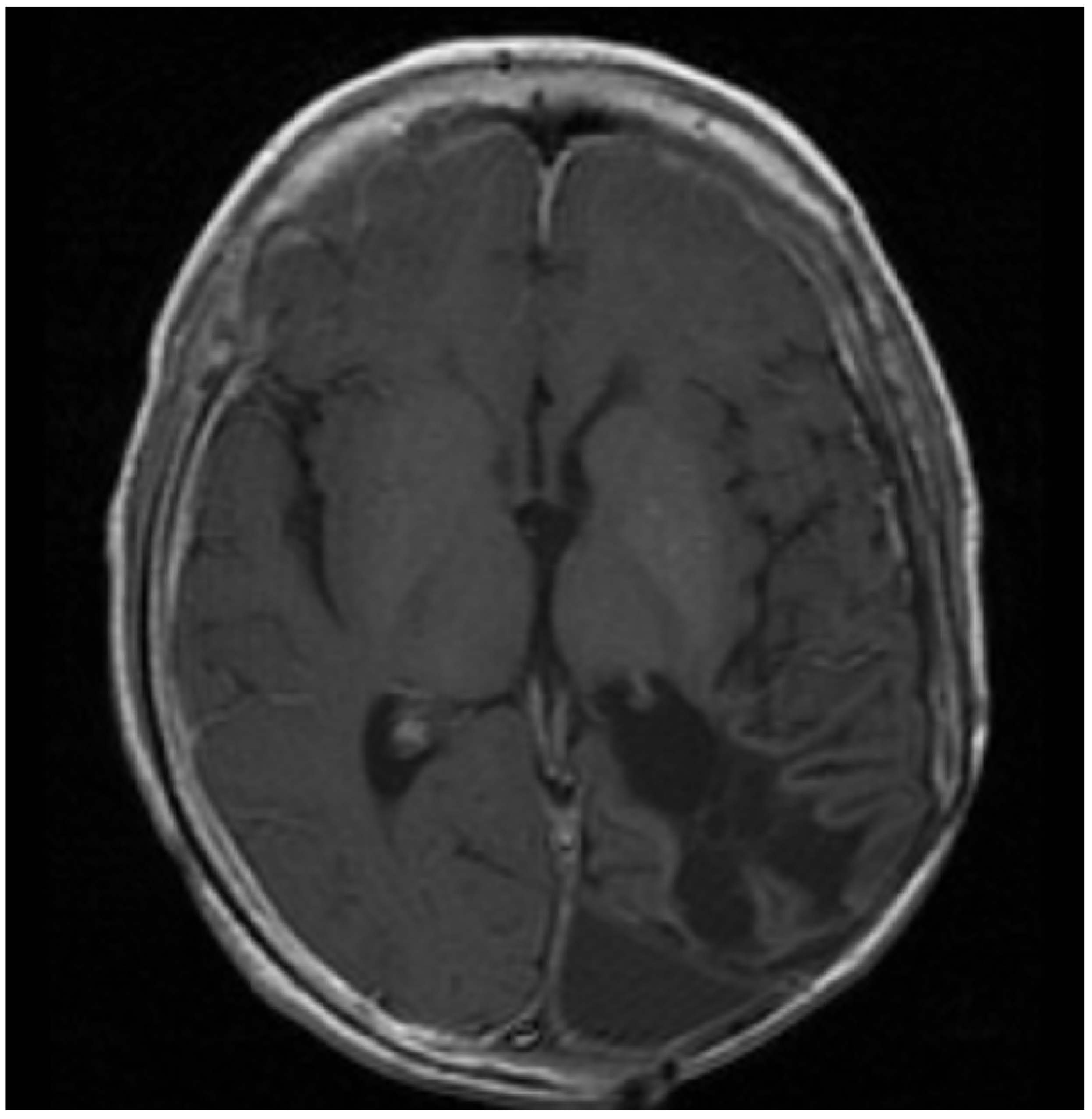 Jcm 11 02849 g002 Jcm 11 02849 g002