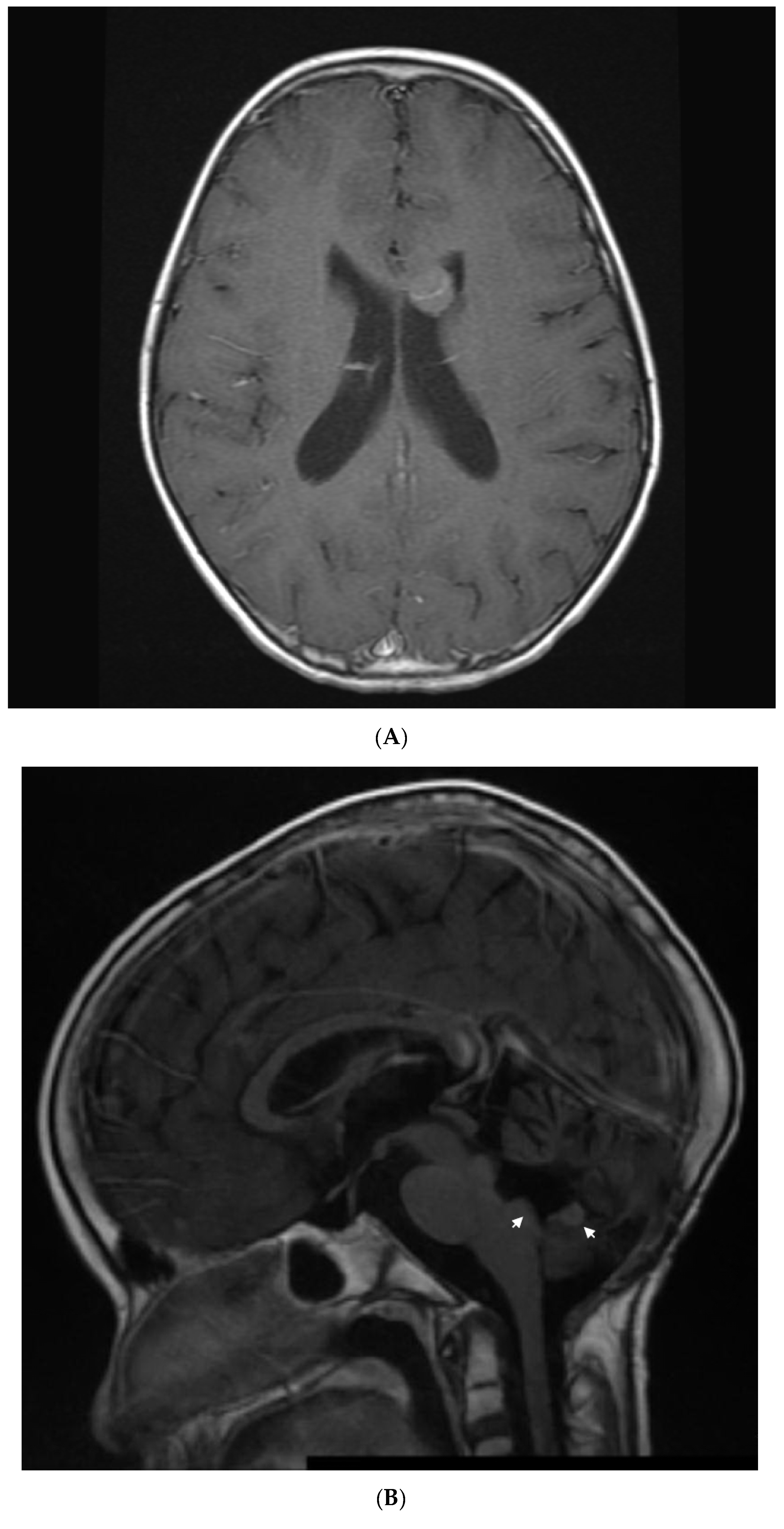 Jcm 11 02849 g003a Jcm 11 02849 g003a