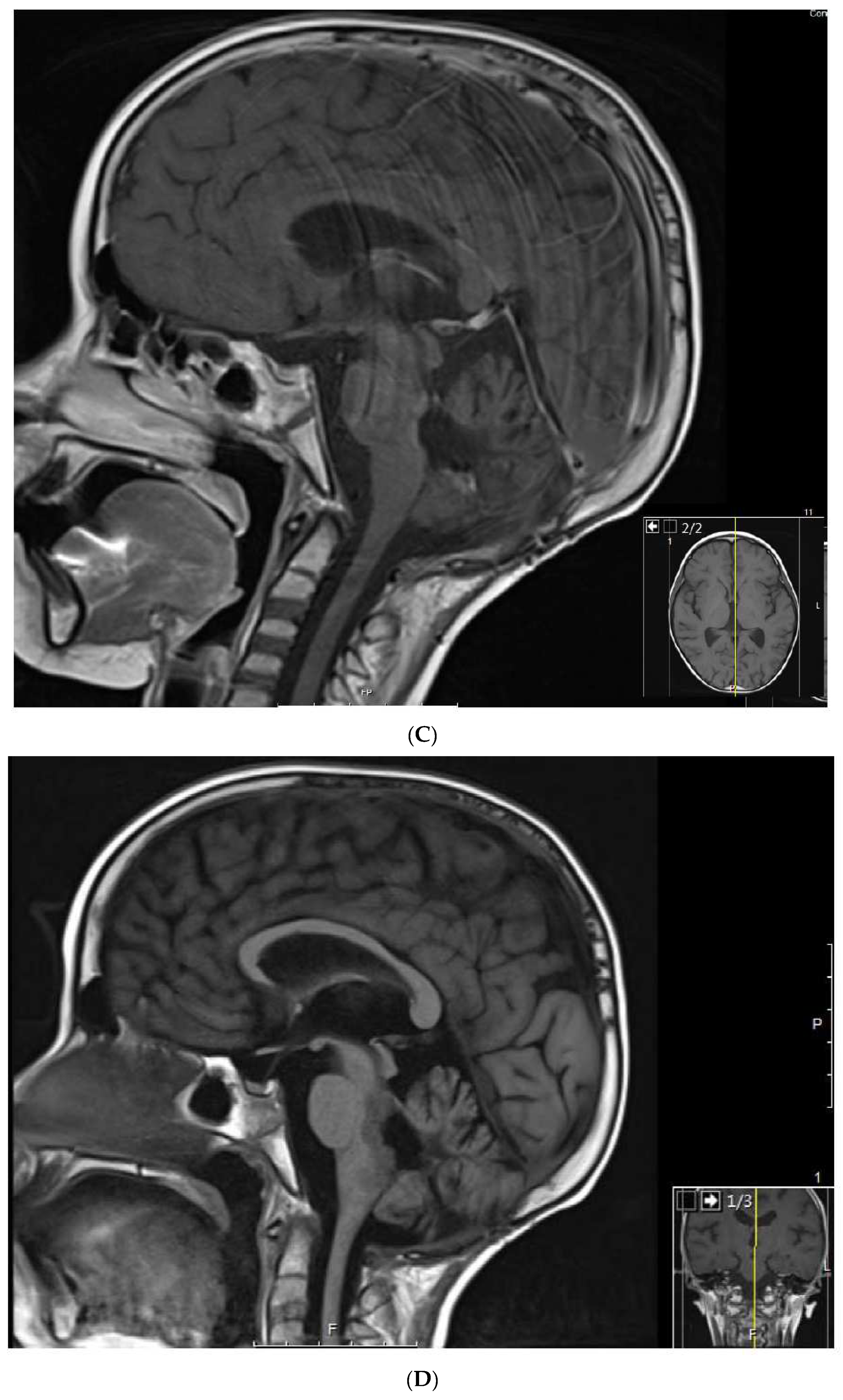 Jcm 11 02849 g003b Jcm 11 02849 g003b