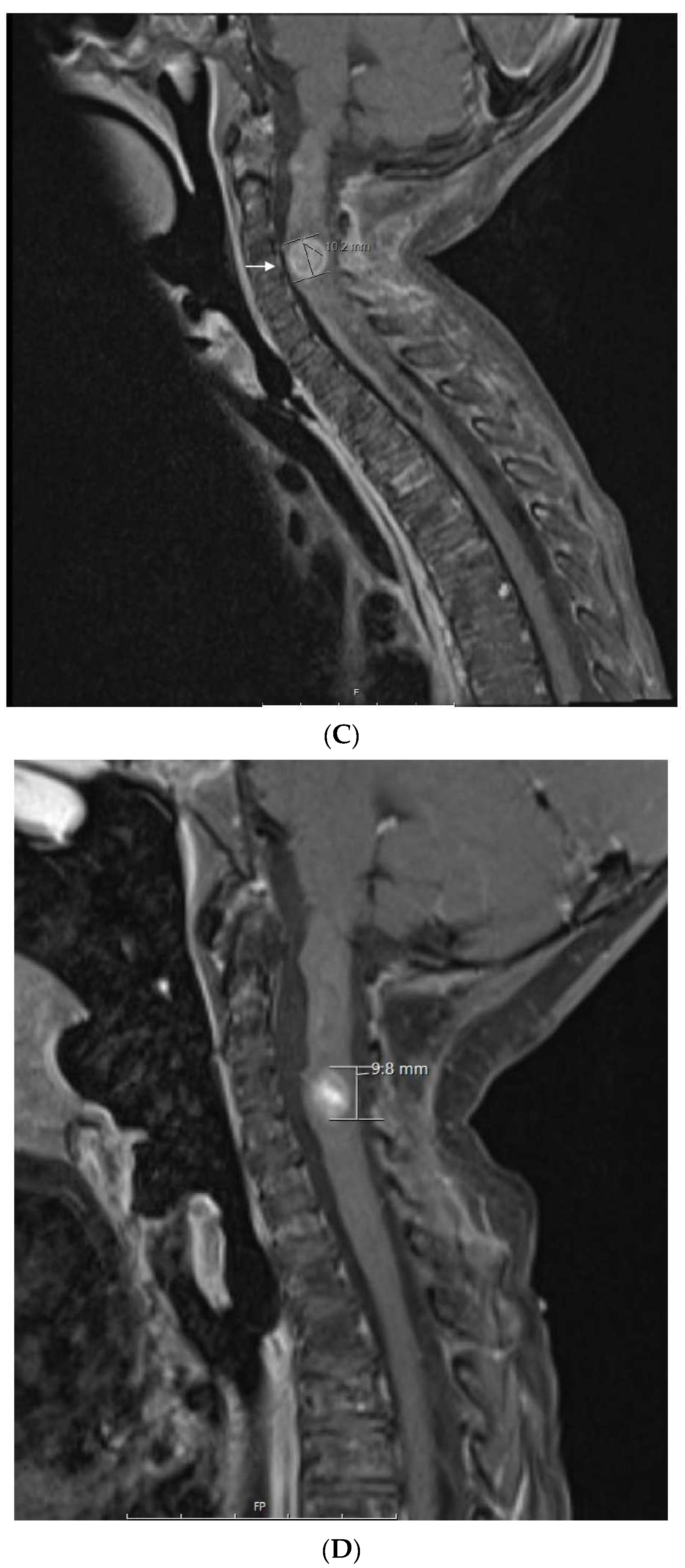 Jcm 11 02849 g004b Jcm 11 02849 g004b