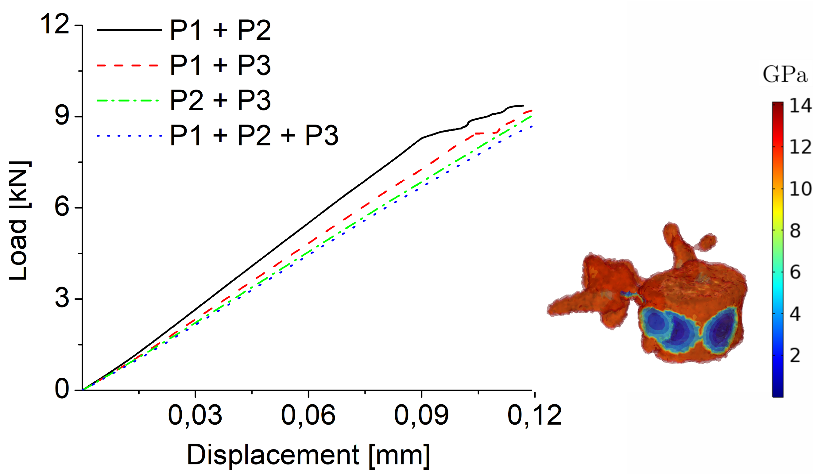 Jcm 11 02850 g009 Jcm 11 02850 g009