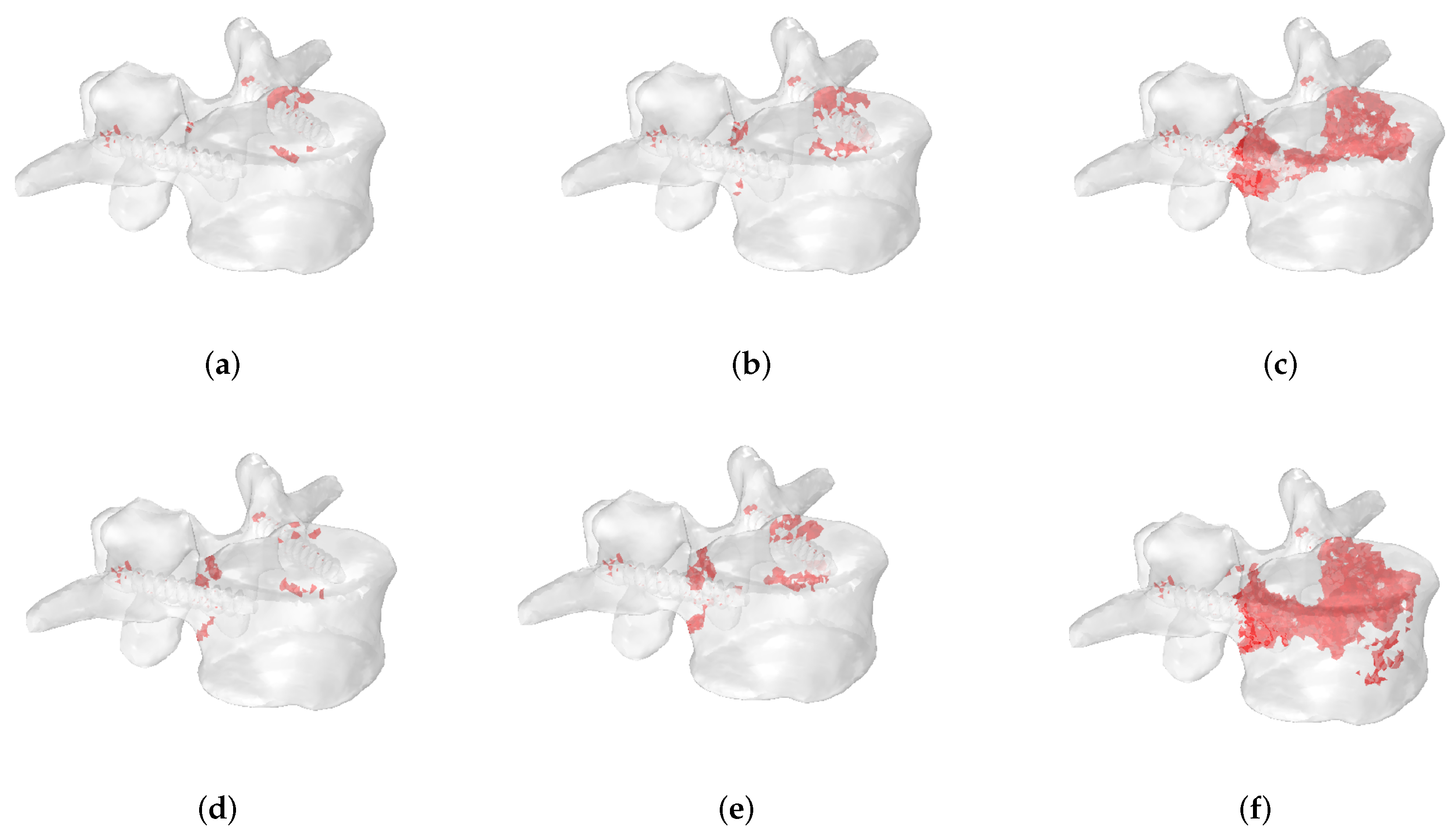 Jcm 11 02850 g012 Jcm 11 02850 g012