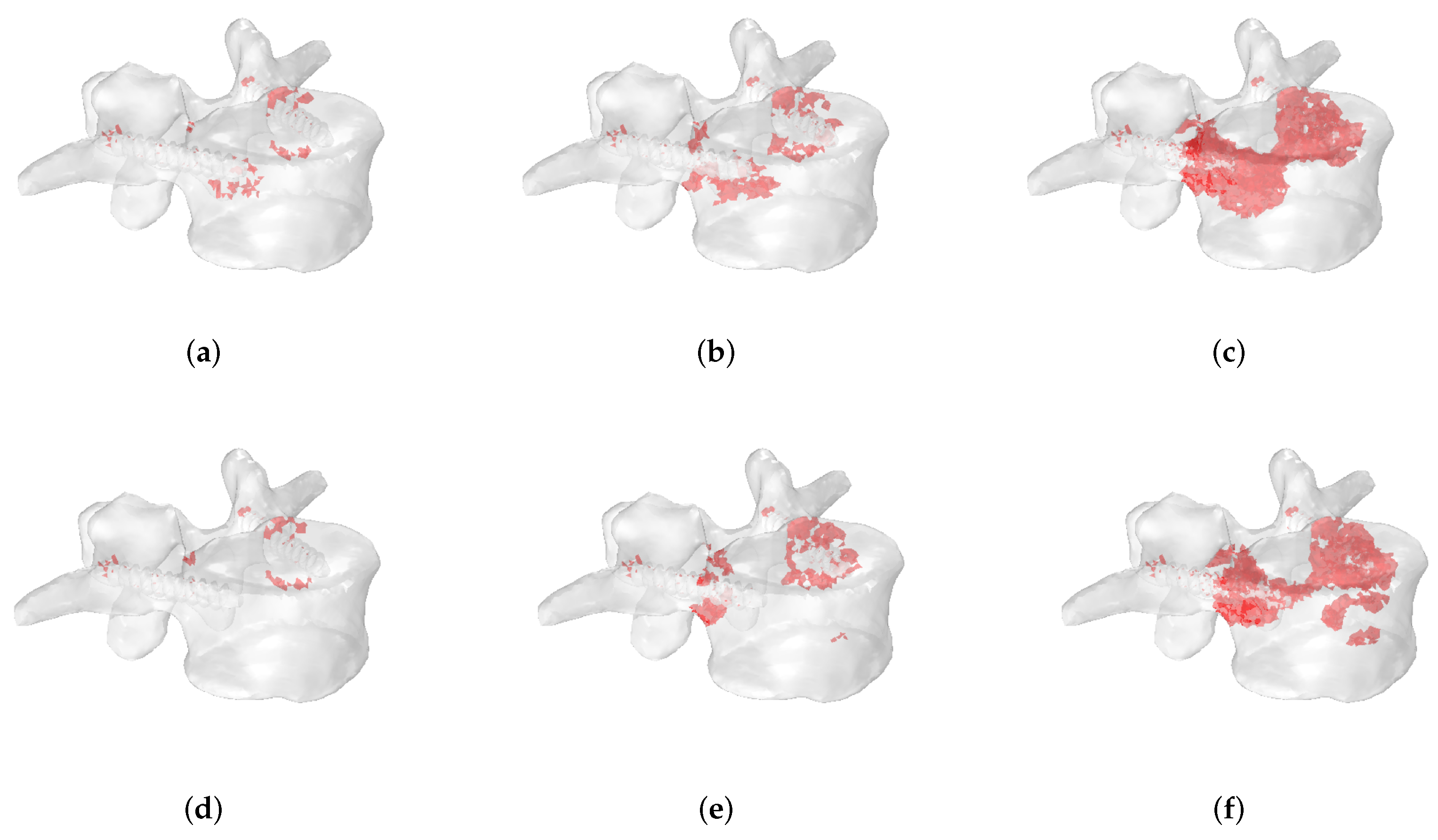 Jcm 11 02850 g013 Jcm 11 02850 g013