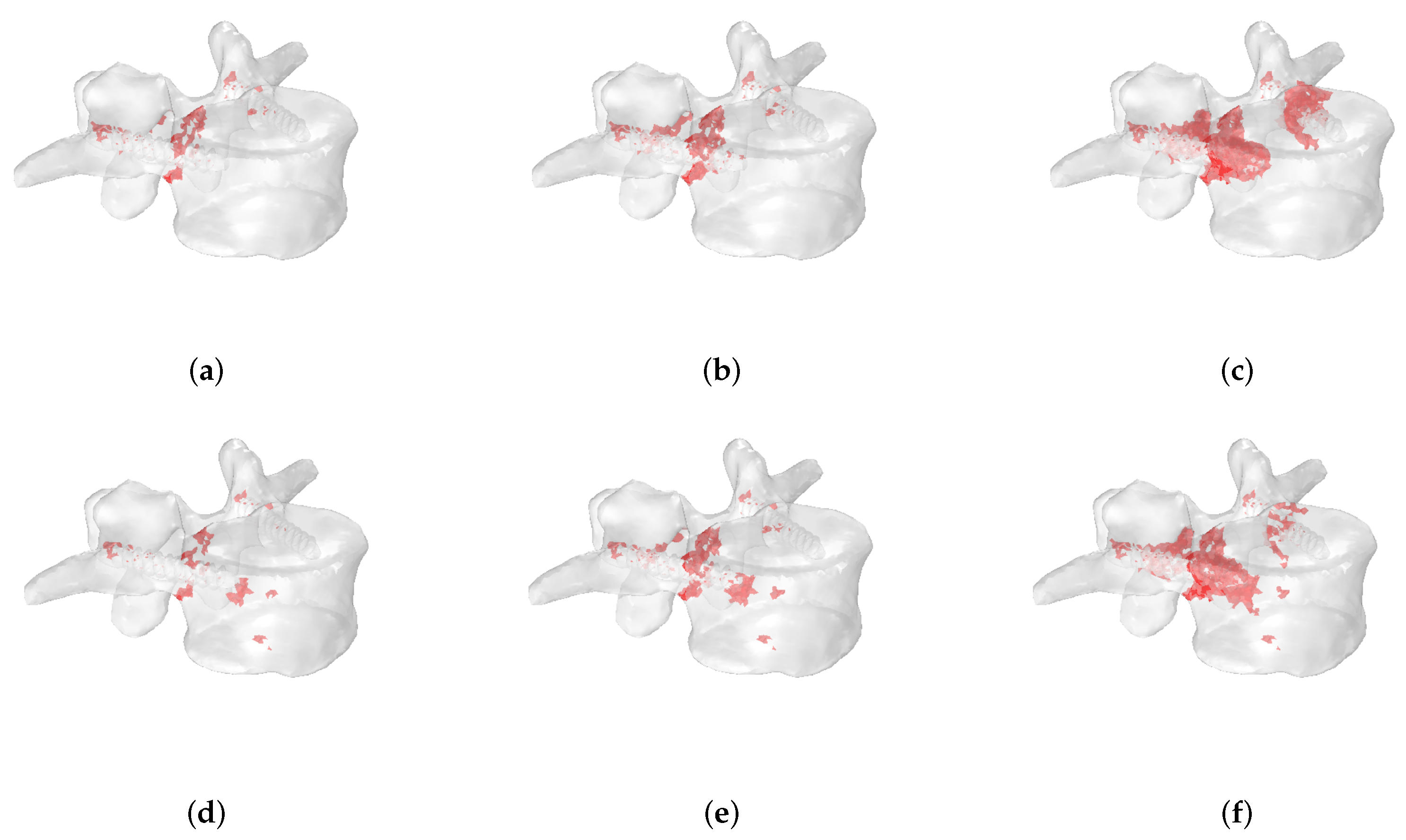 Jcm 11 02850 g014 Jcm 11 02850 g014