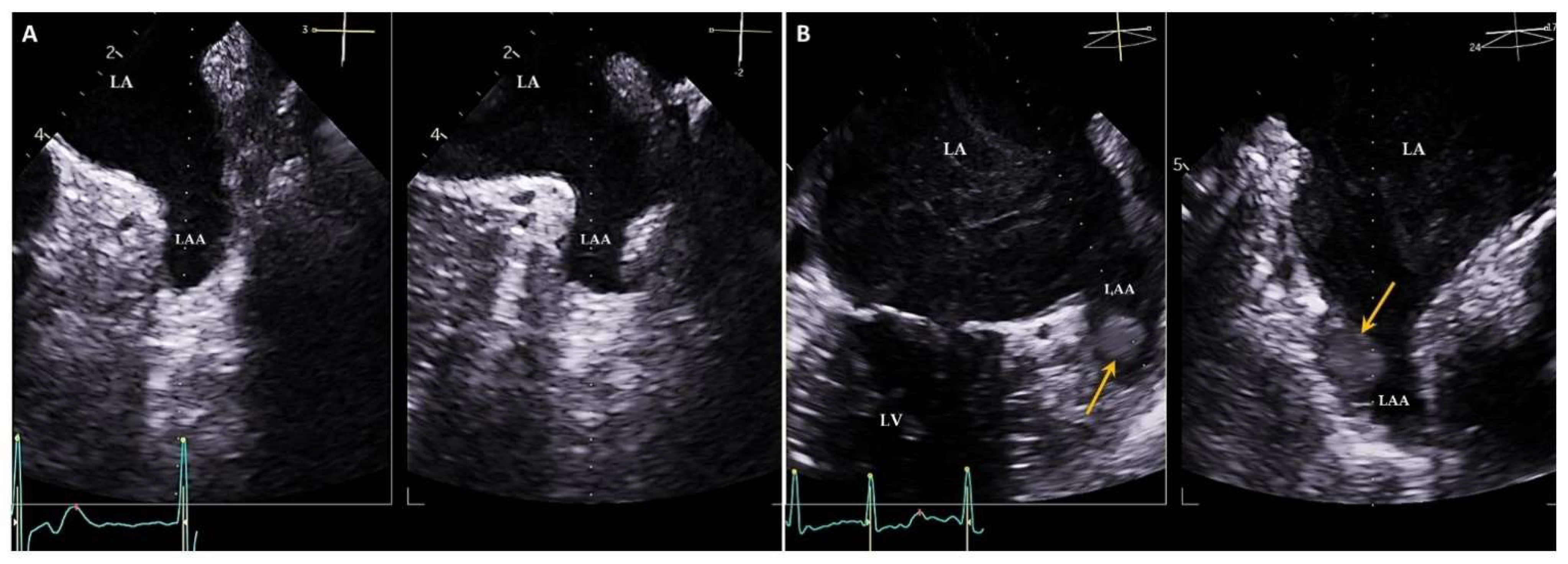 Jcm 11 02854 g005 550
