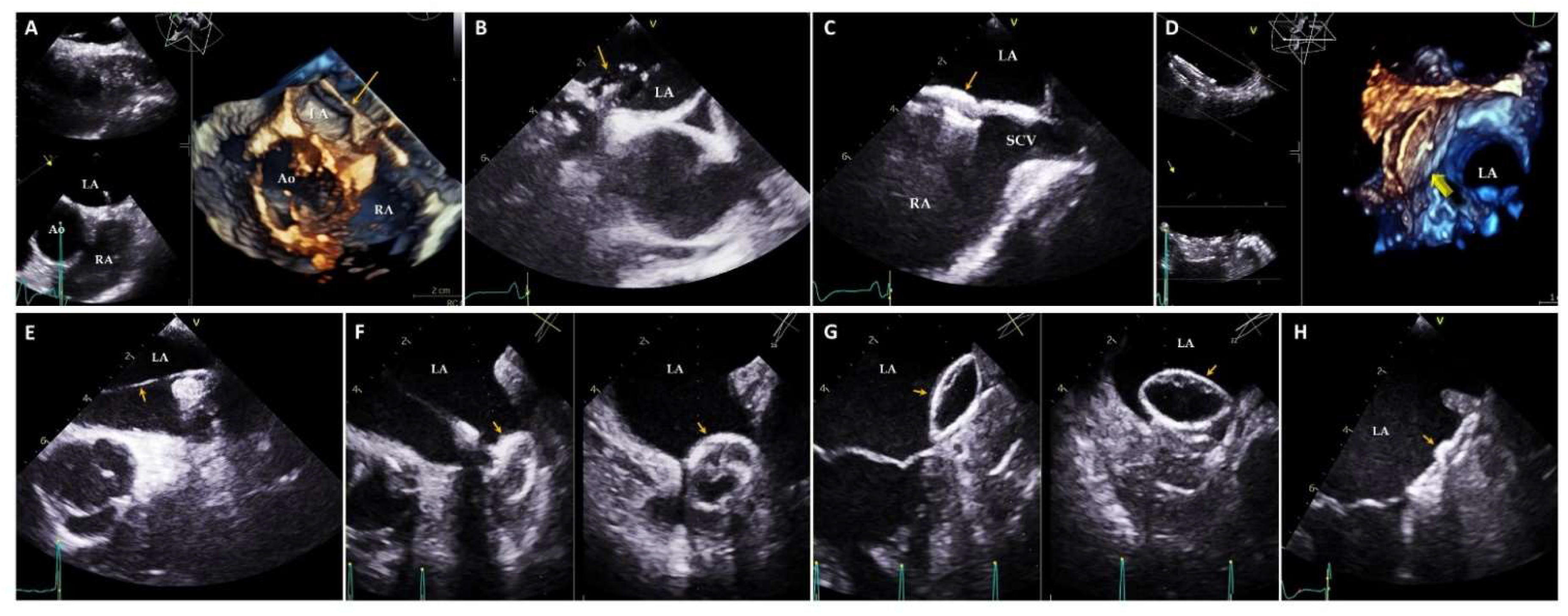 Jcm 11 02854 g006 550