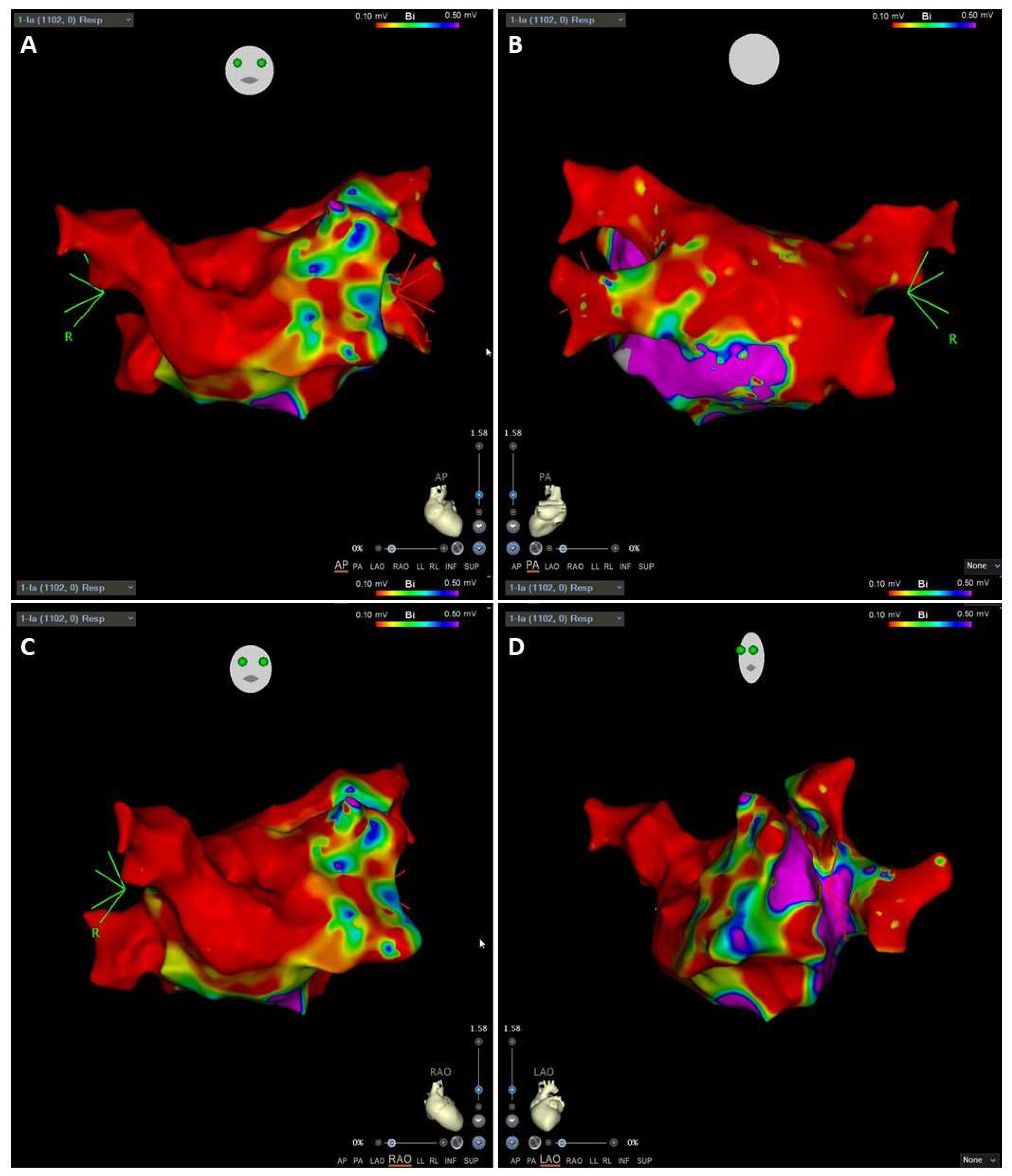 Jcm 11 02854 g011 550