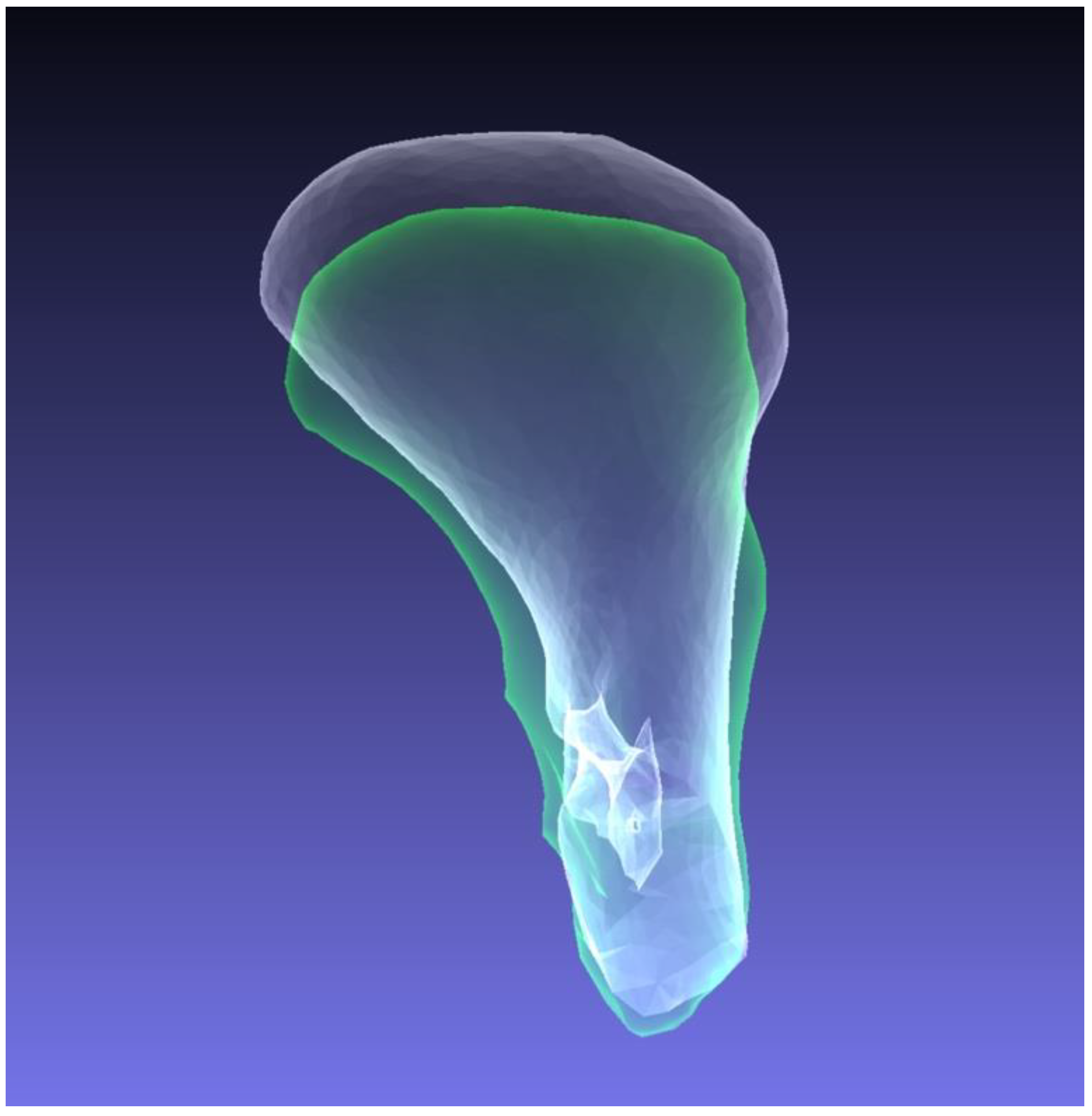 Jcm 11 02868 g004 550