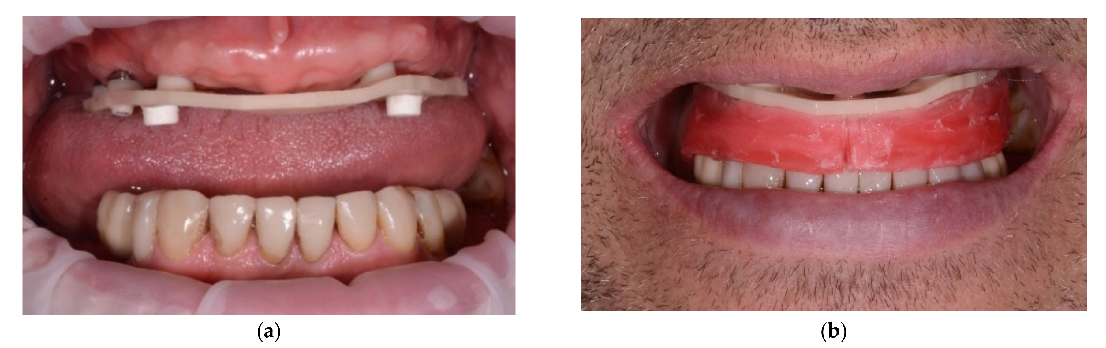 JCM Free FullText Reliability and Time Efficiency of Digital vs