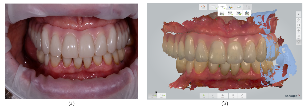 Jcm 11 02882 g002 550