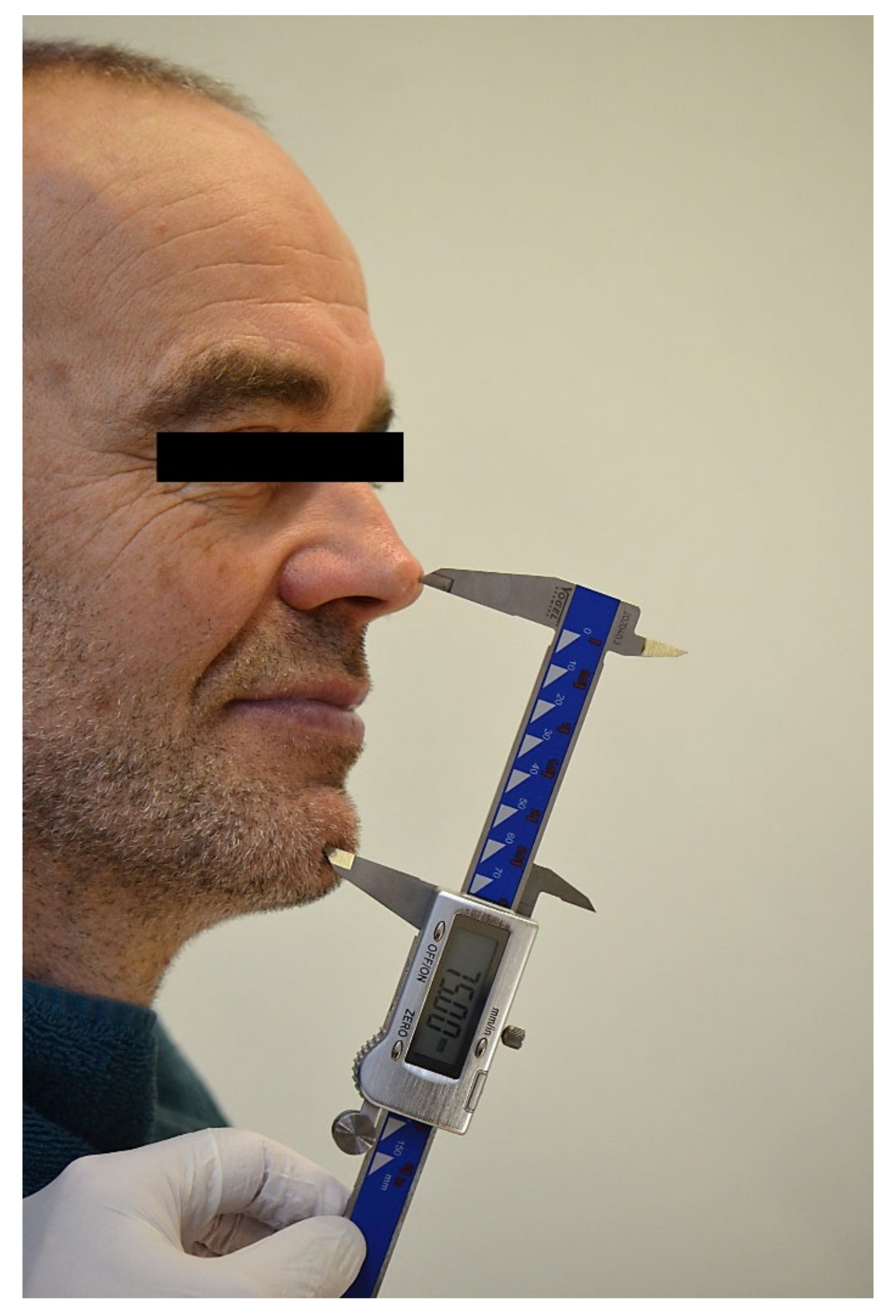 Jcm 11 02882 g003 550