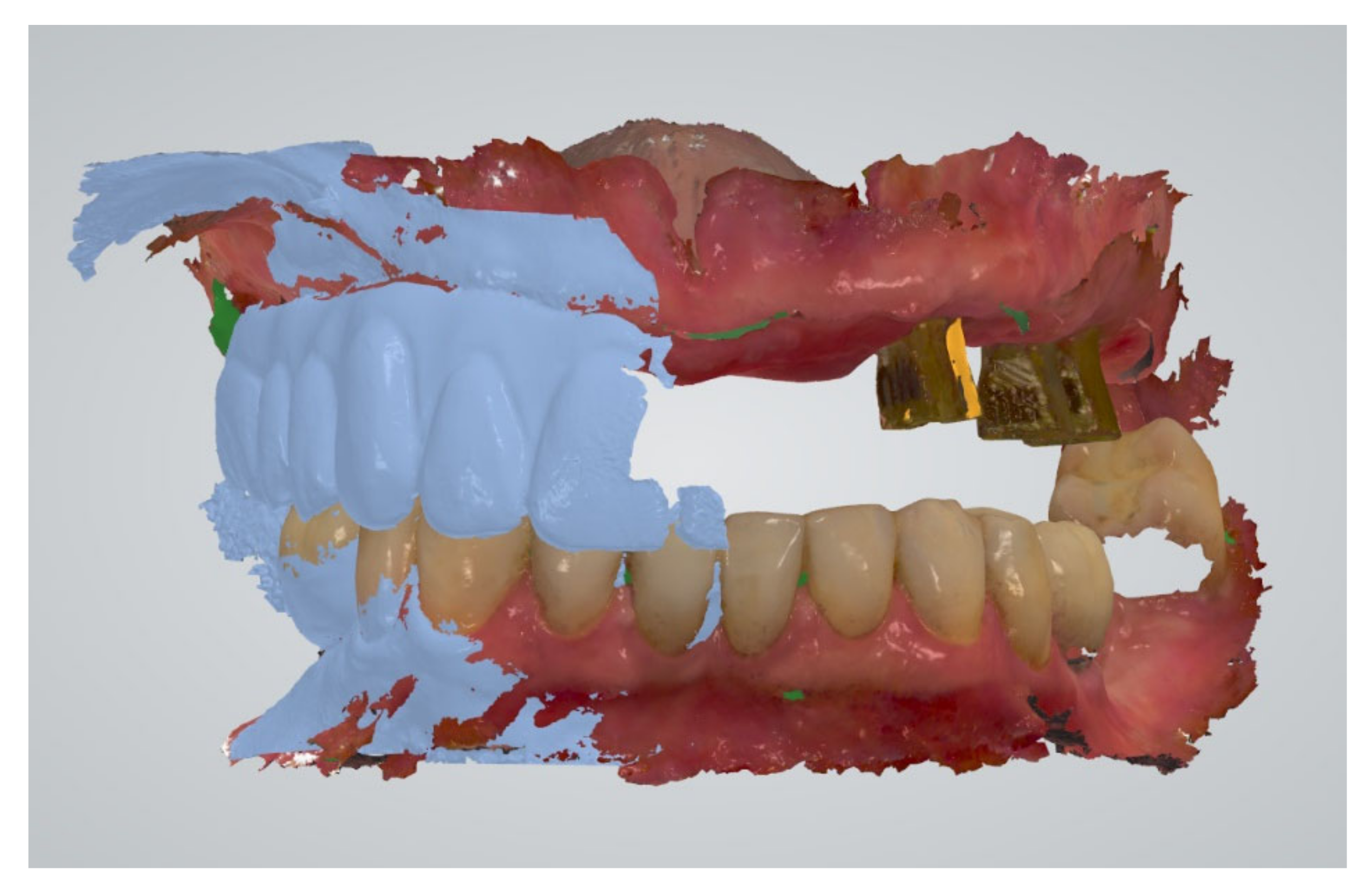JCM Free FullText Reliability and Time Efficiency of Digital vs