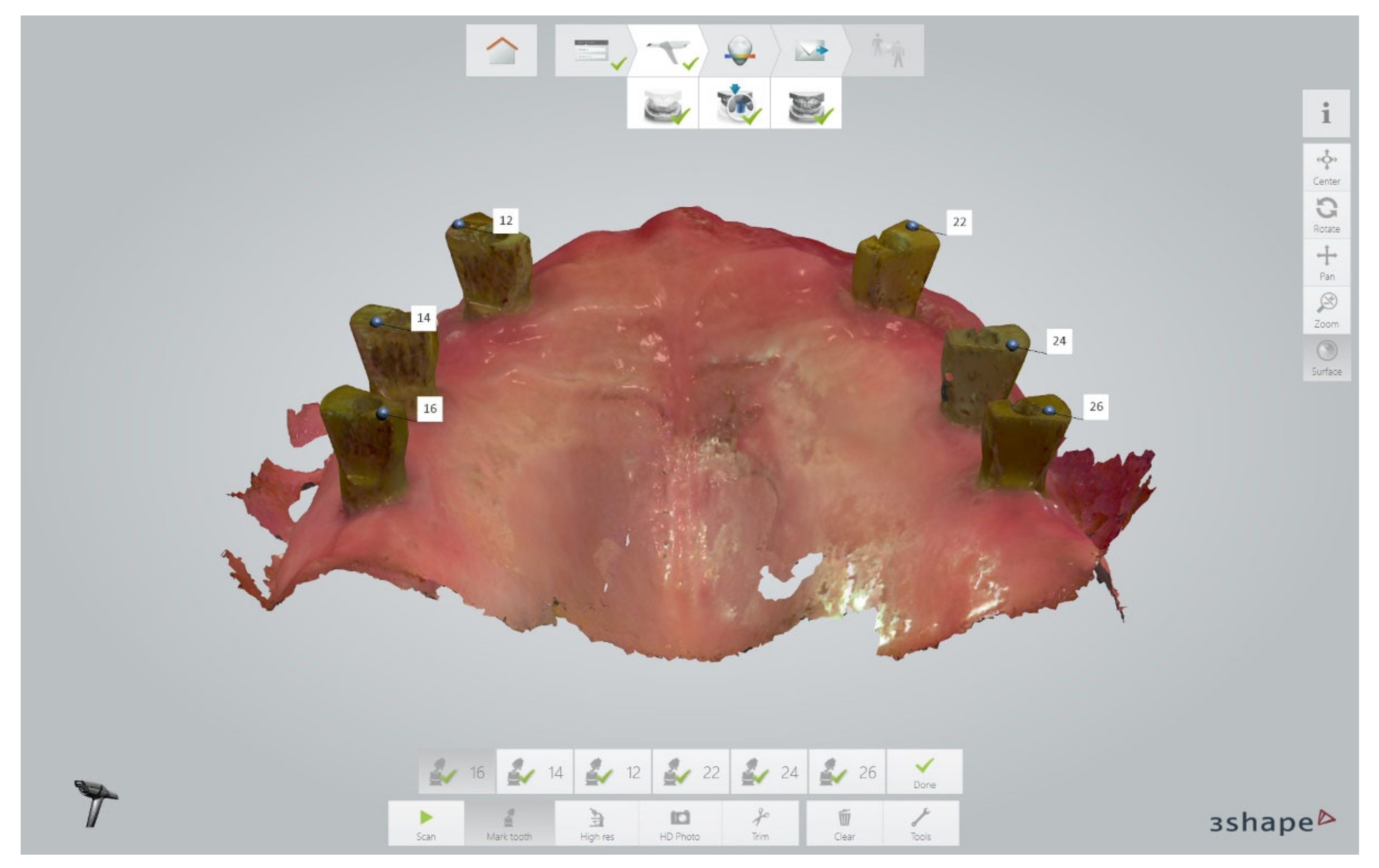 Jcm 11 02882 g006 550