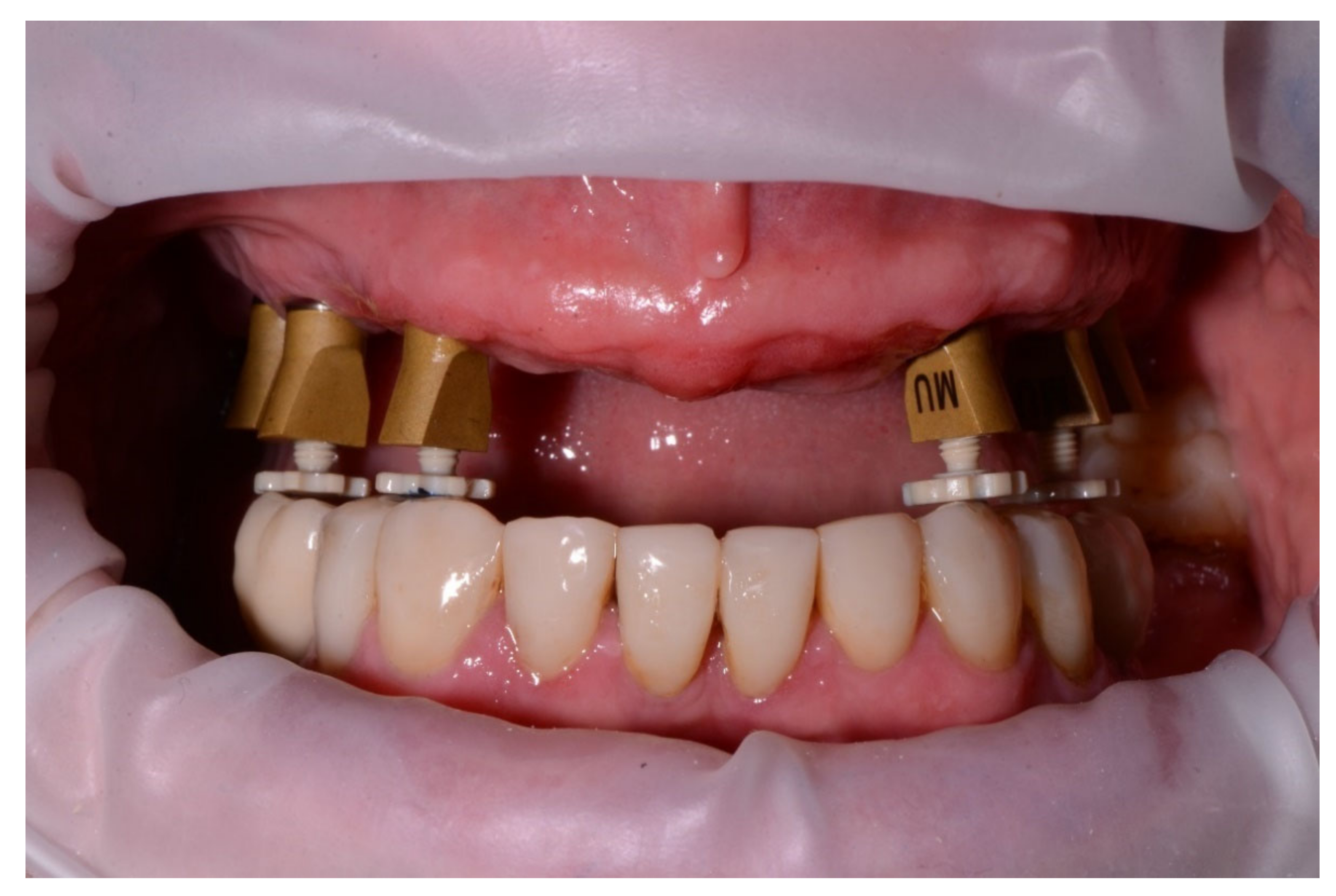 Jcm 11 02882 g007 550