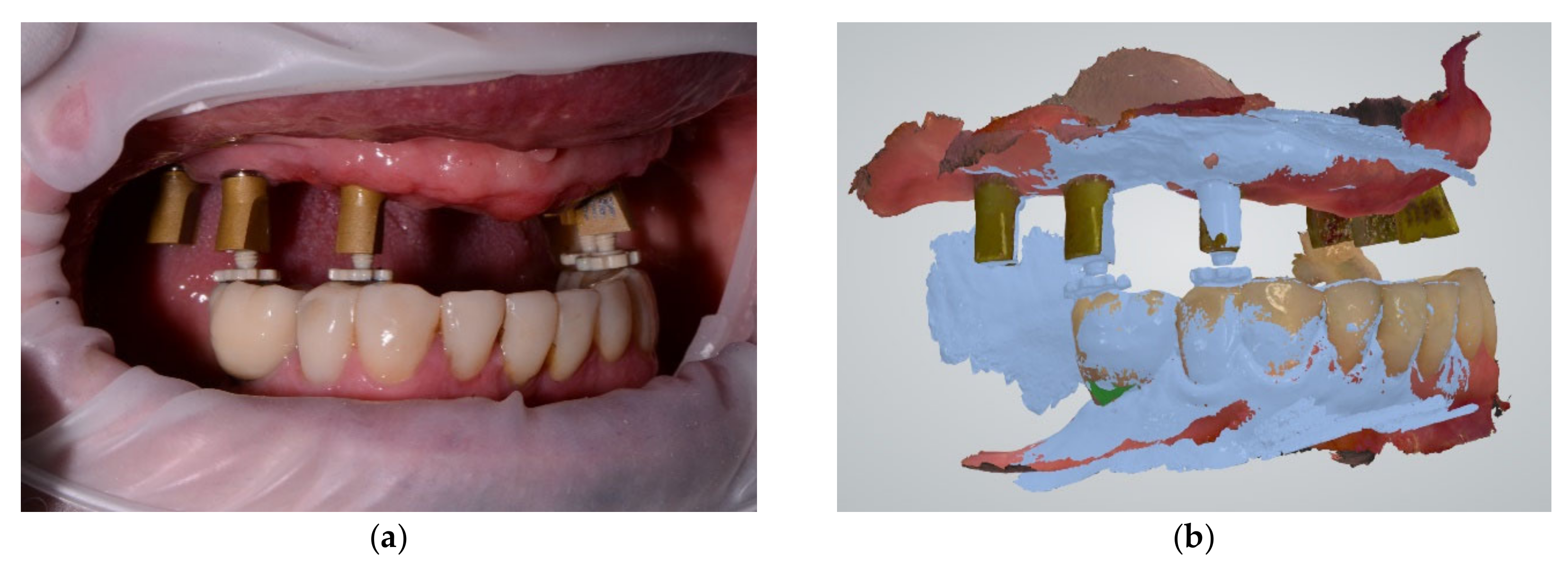 JCM Free FullText Reliability and Time Efficiency of Digital vs
