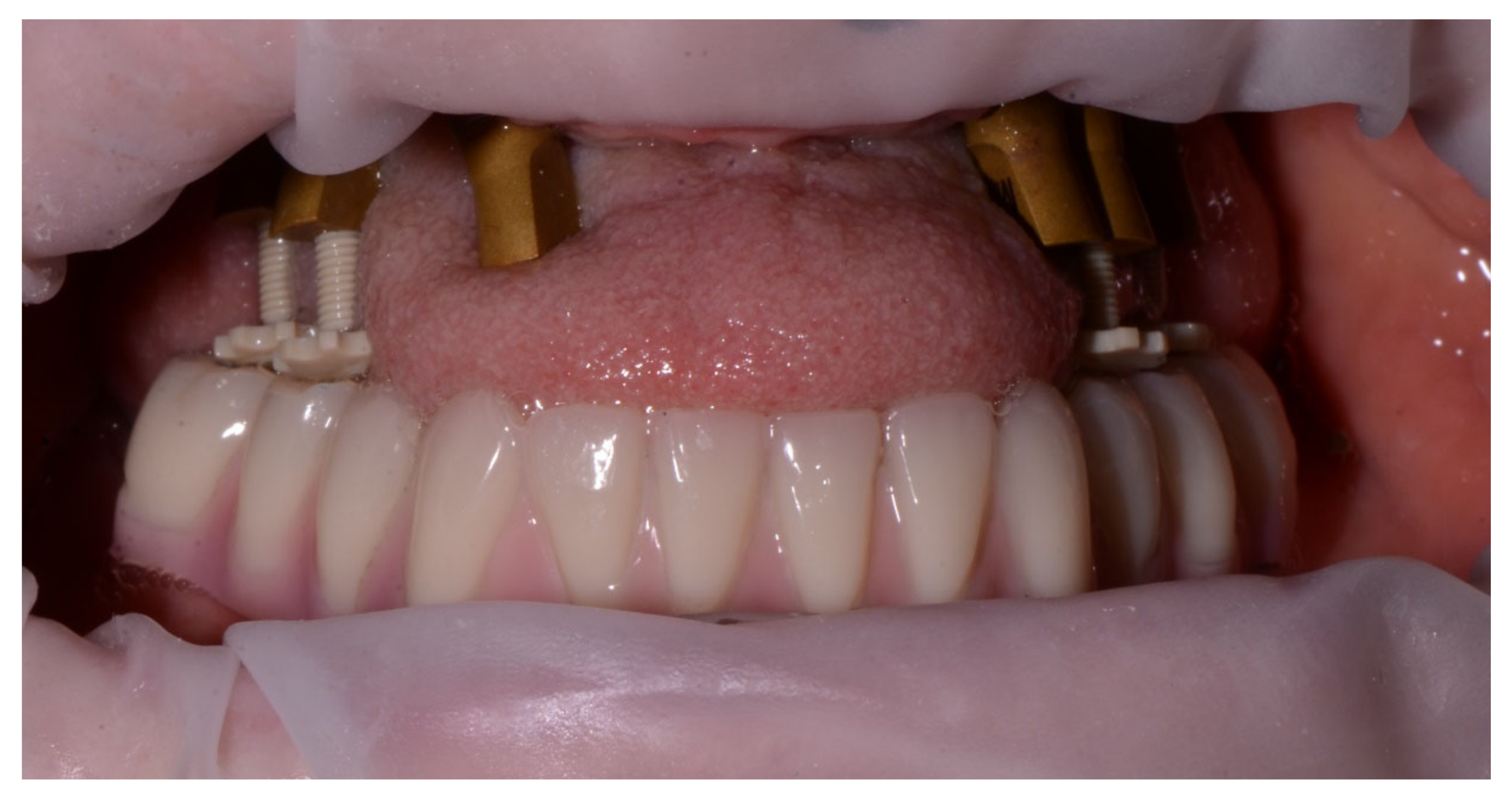 Jcm 11 02882 g015 550