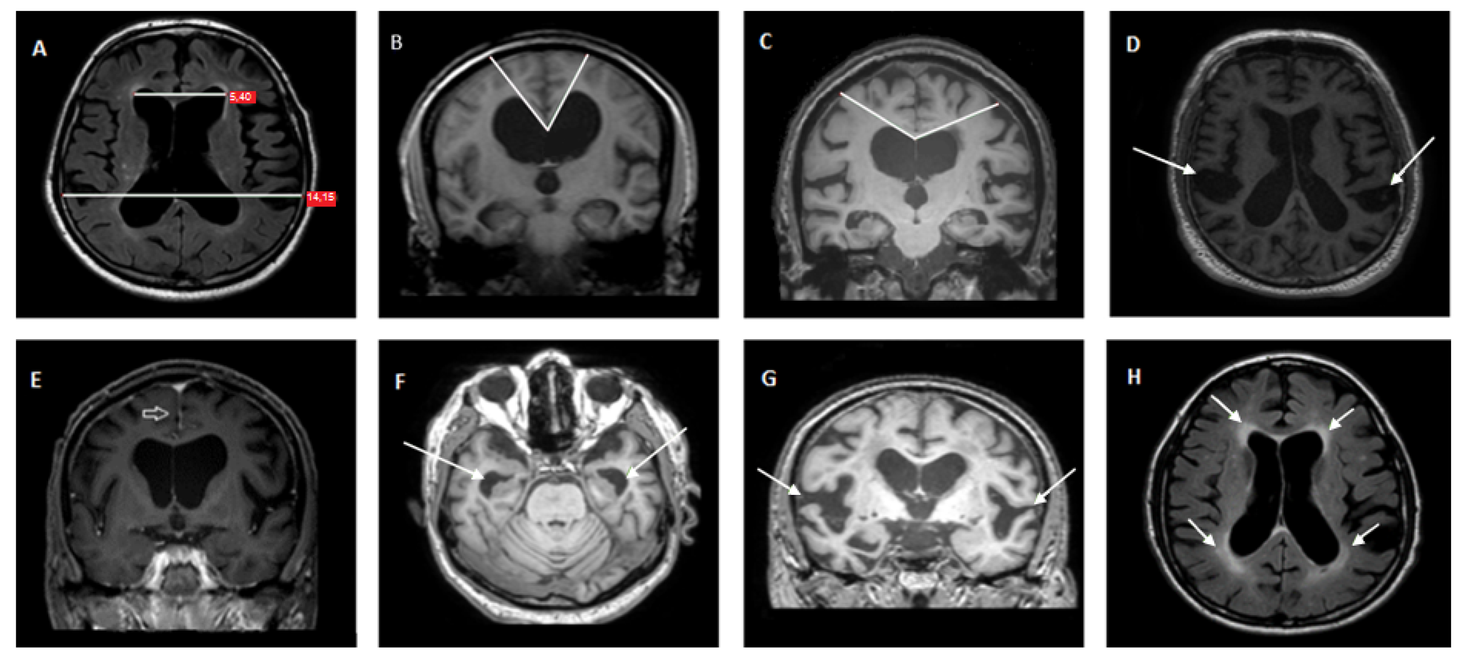 Jcm 11 02898 g001 Jcm 11 02898 g001