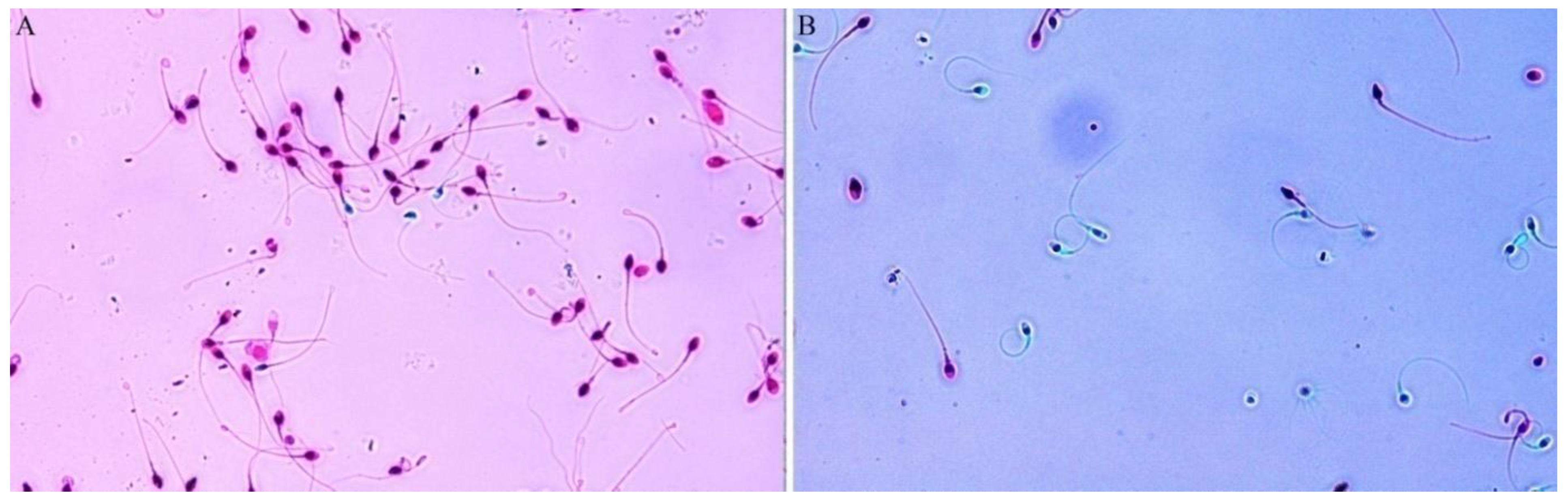 Jcm 11 02914 g002 550