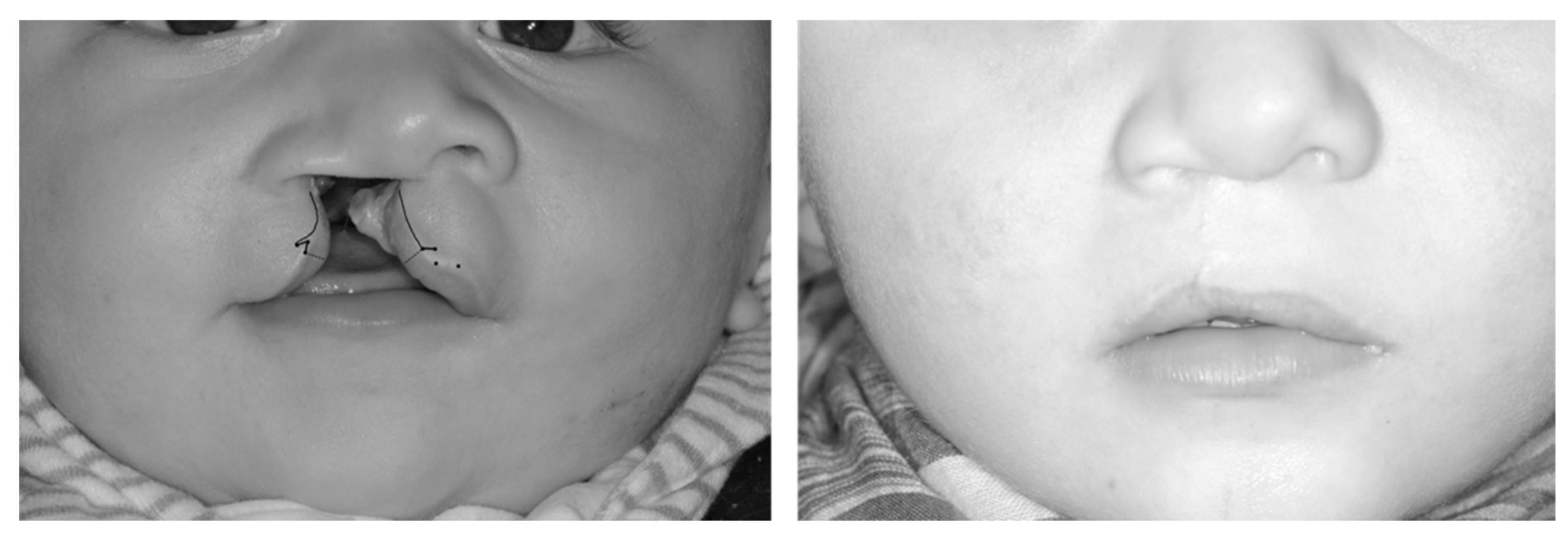 Jcm 11 02943 g002 550