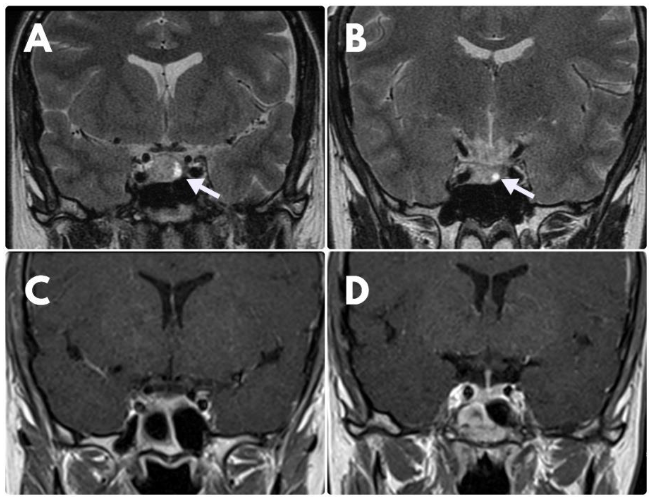 Jcm 11 03070 g002 550