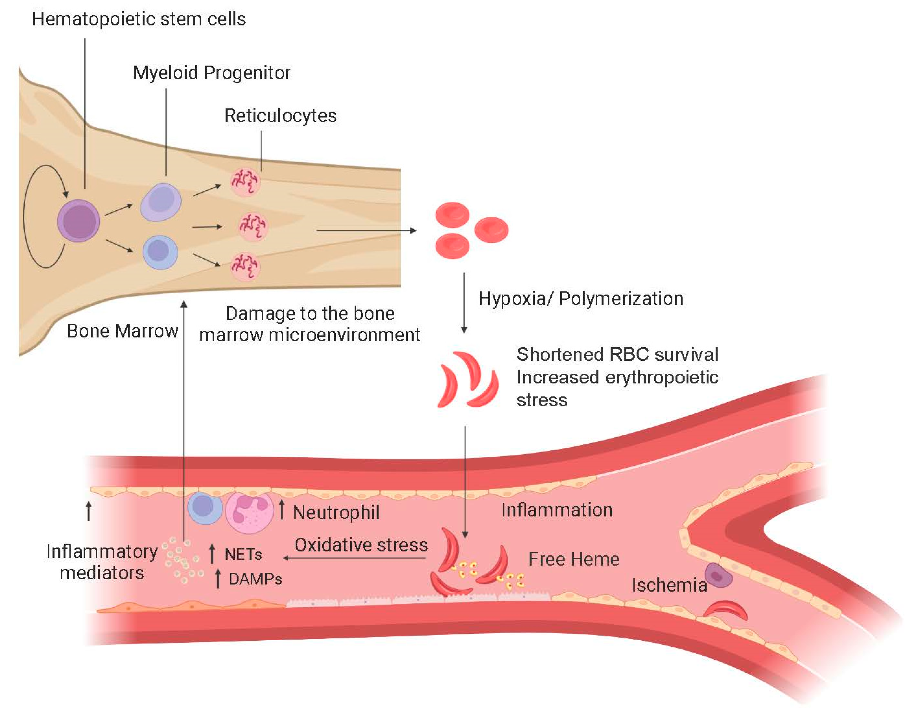 Bone Marrow Transplant And Sickle Cell Disease JCM | Free Full-Text | Clonal Hematopoiesis and the Risk of Hematologic