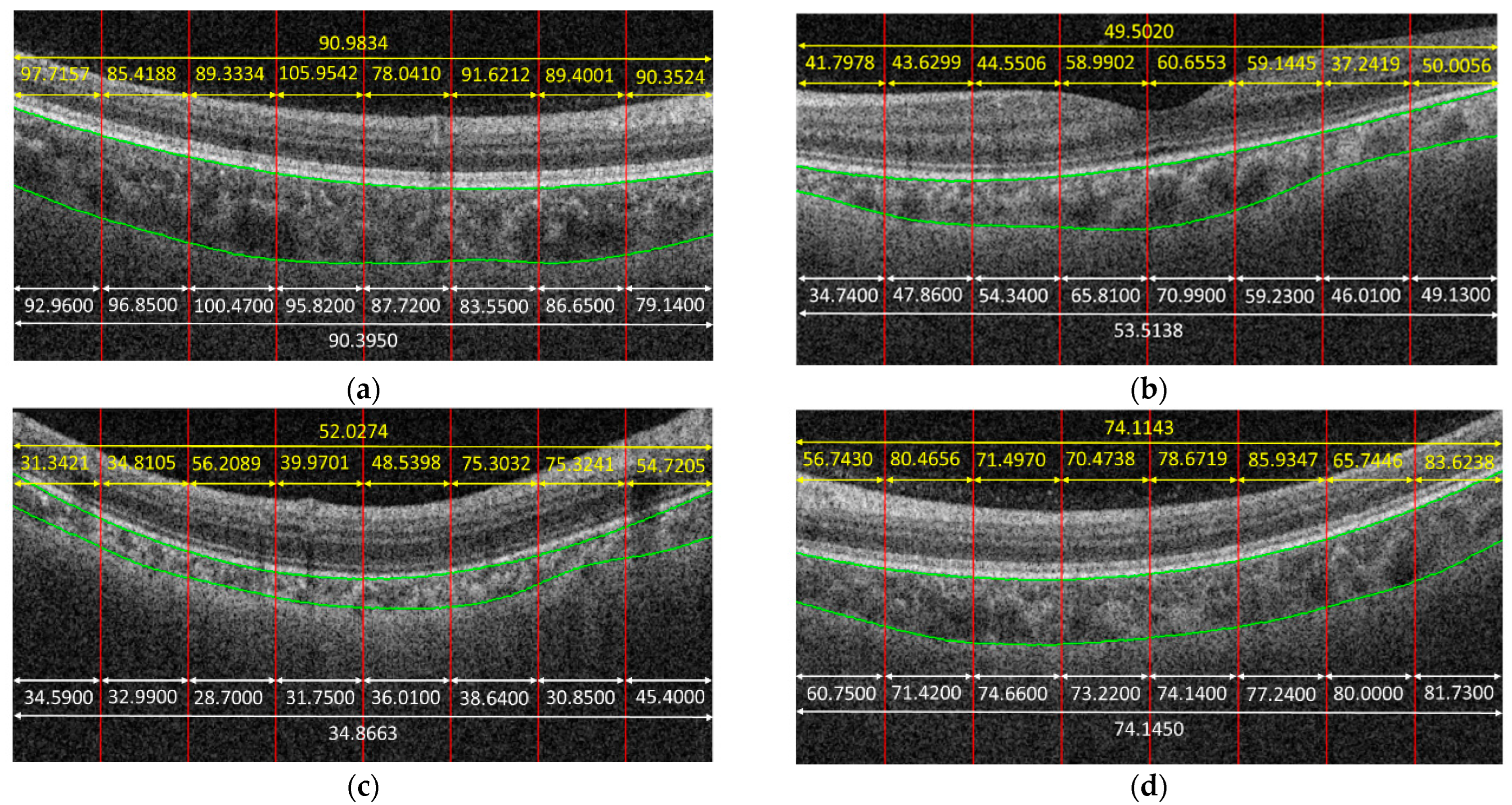 Jcm 11 03203 g004a 550