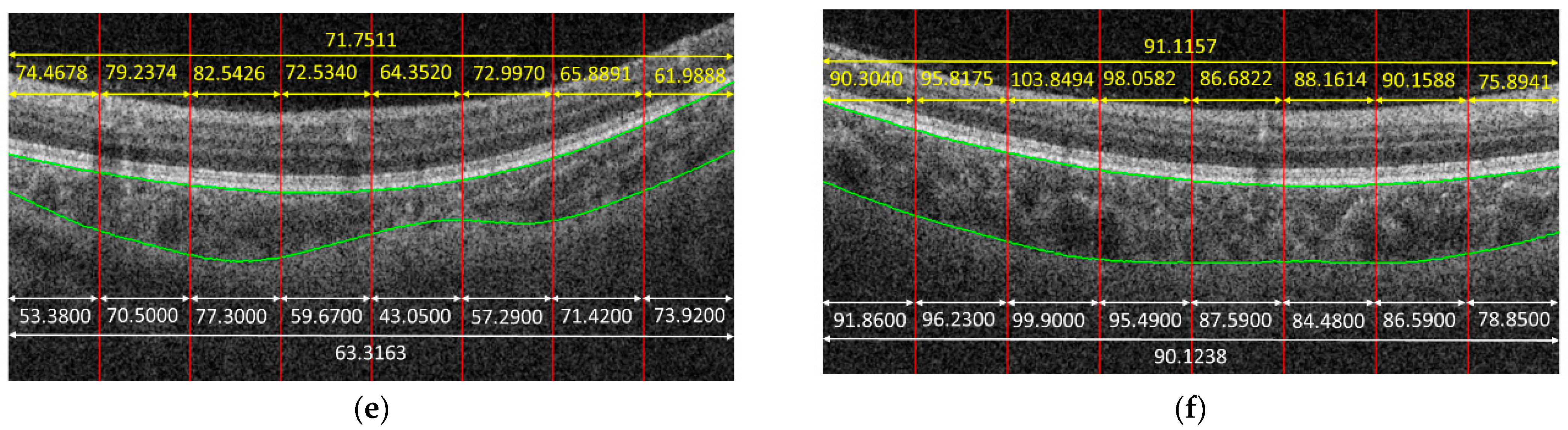 Jcm 11 03203 g004b 550