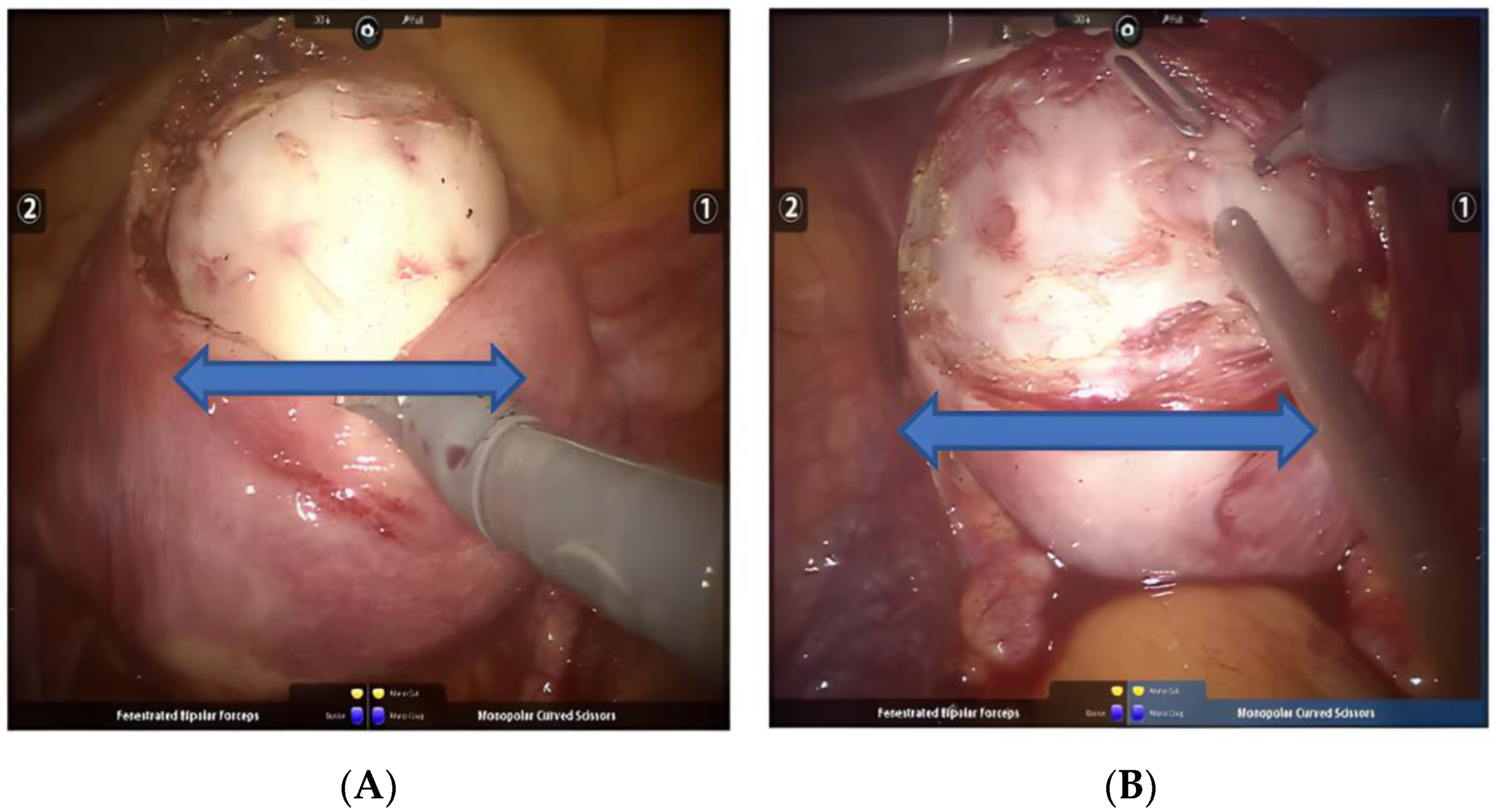 Jcm 11 03221 g002 Jcm 11 03221 g002