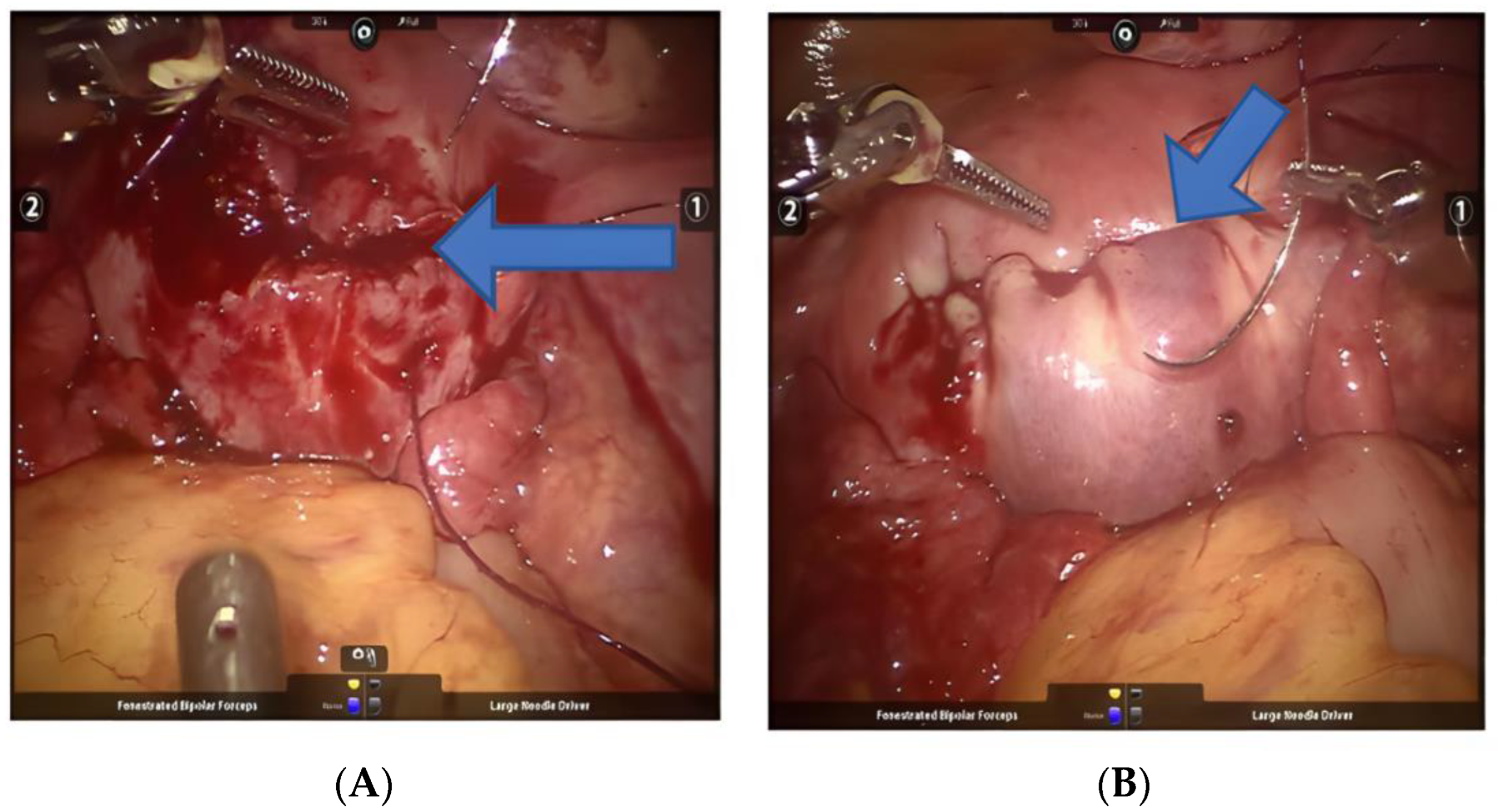 Jcm 11 03221 g004 Jcm 11 03221 g004