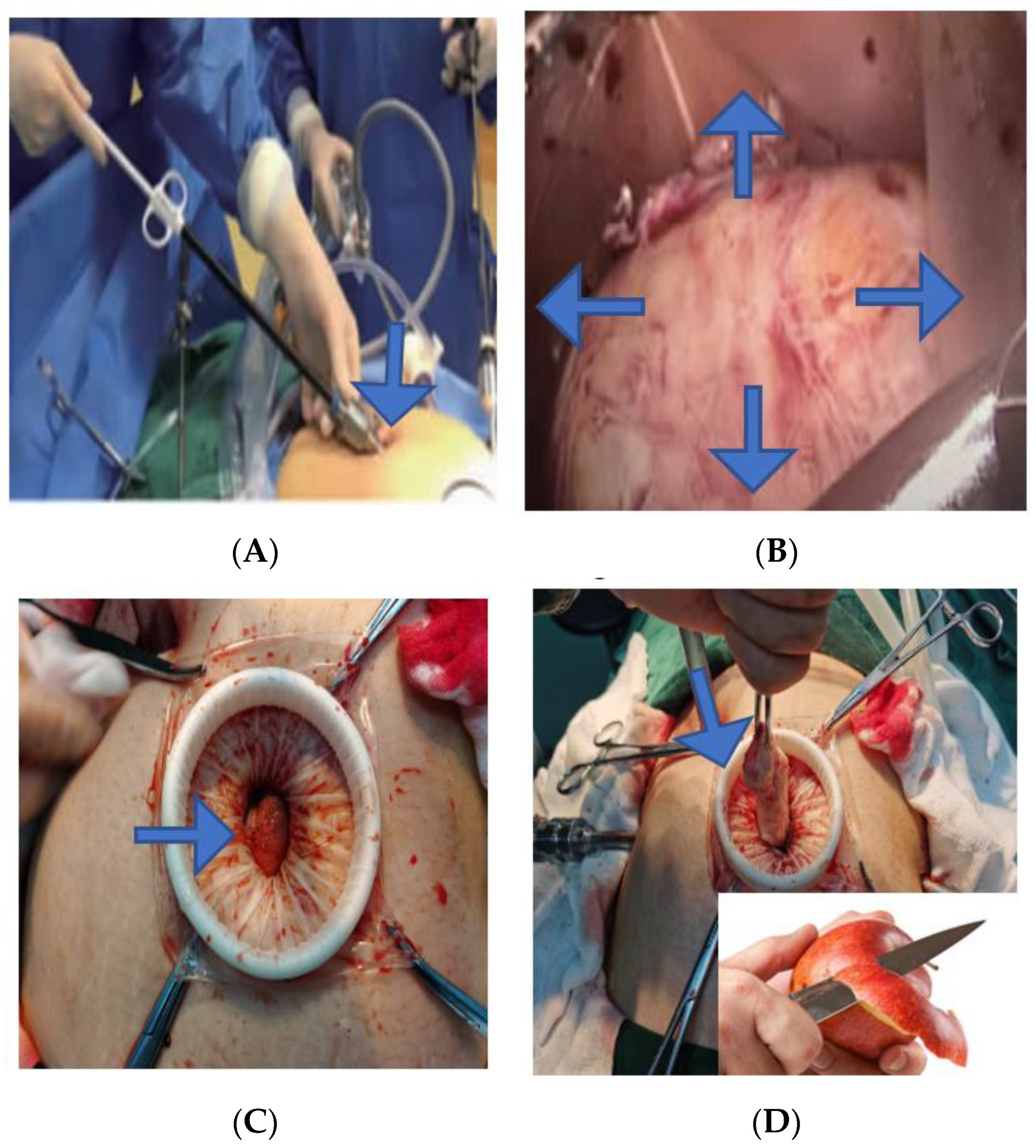 Jcm 11 03221 g005a Jcm 11 03221 g005a