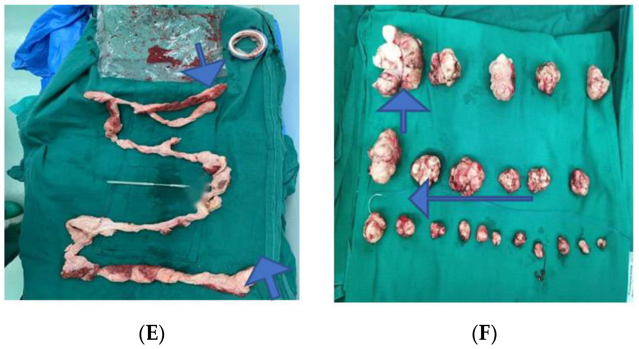 Jcm 11 03221 g005b Jcm 11 03221 g005b