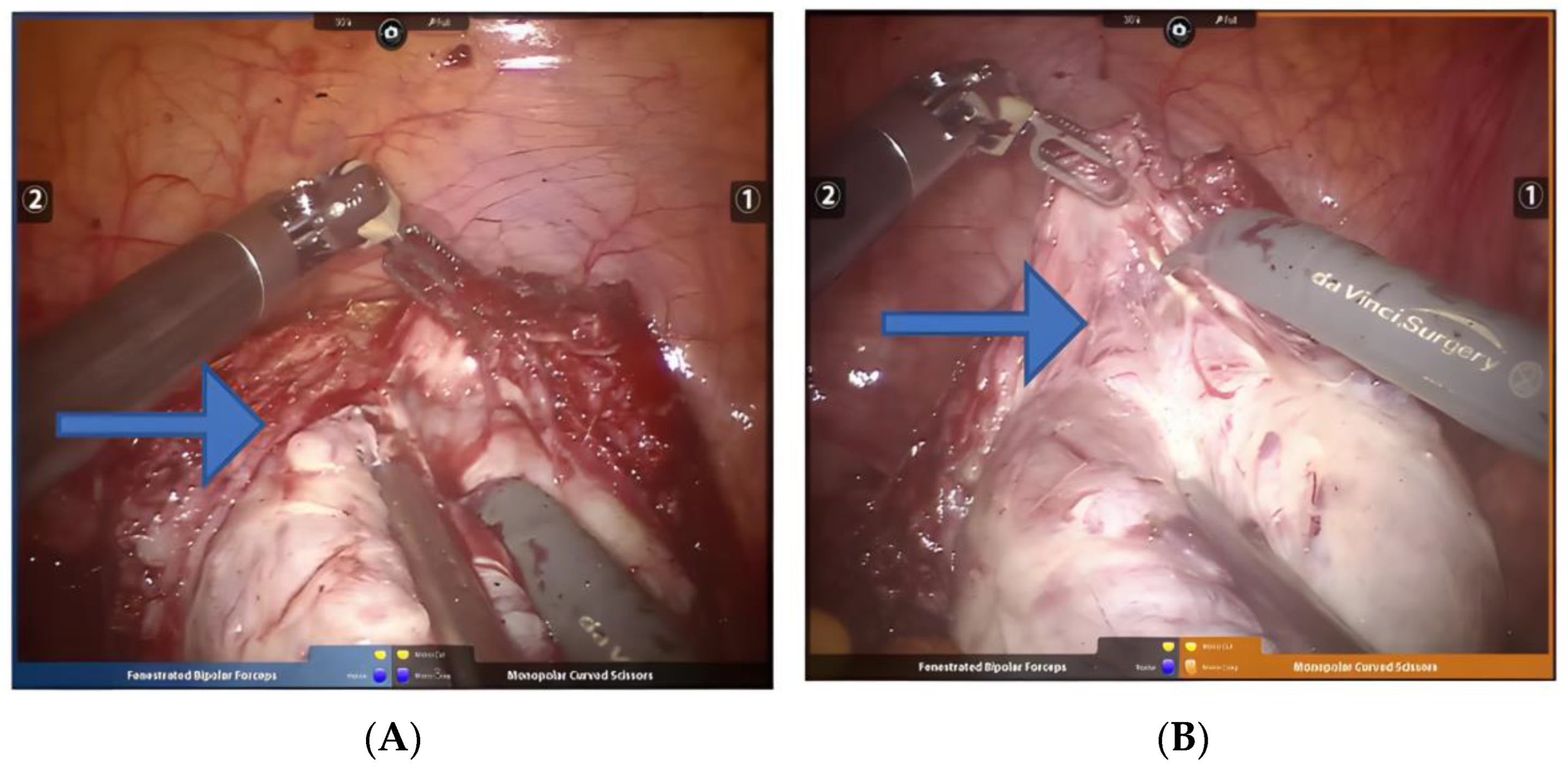 Jcm 11 03221 g007 Jcm 11 03221 g007