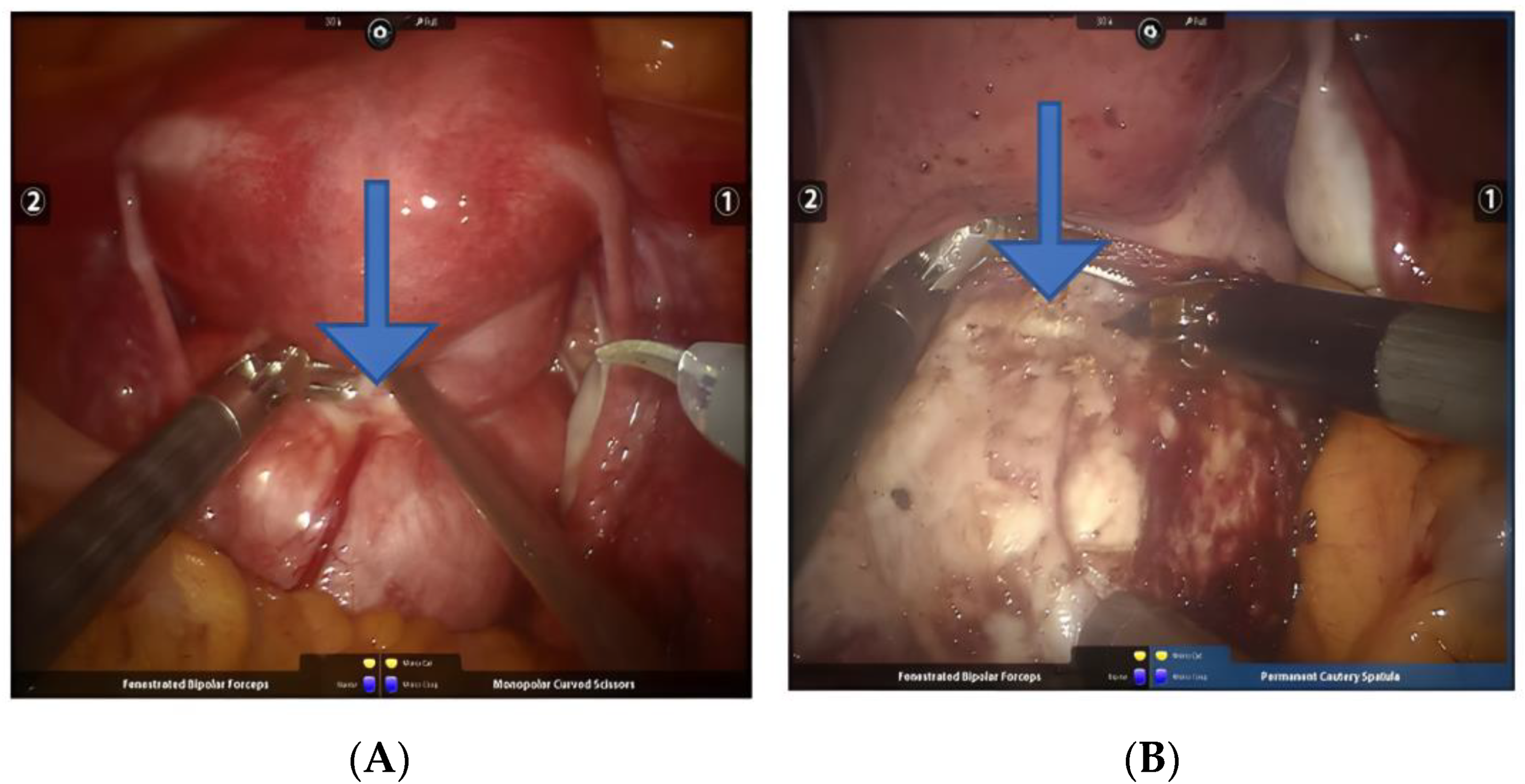 Jcm 11 03221 g008 Jcm 11 03221 g008