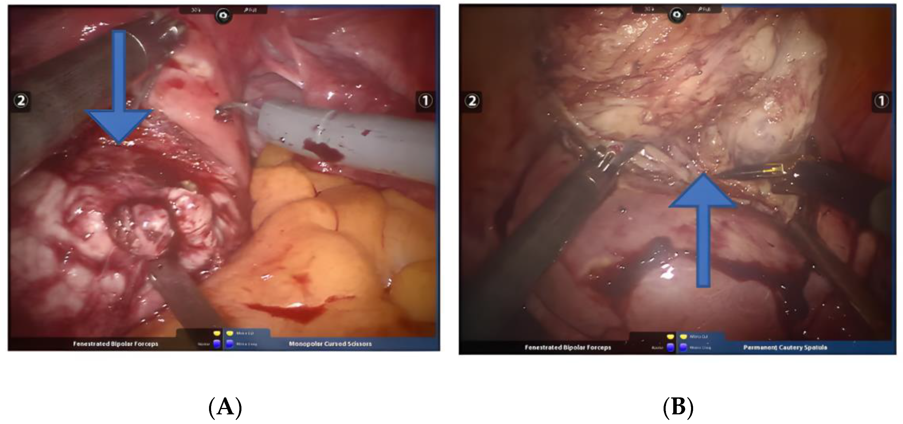 Jcm 11 03221 g009 Jcm 11 03221 g009