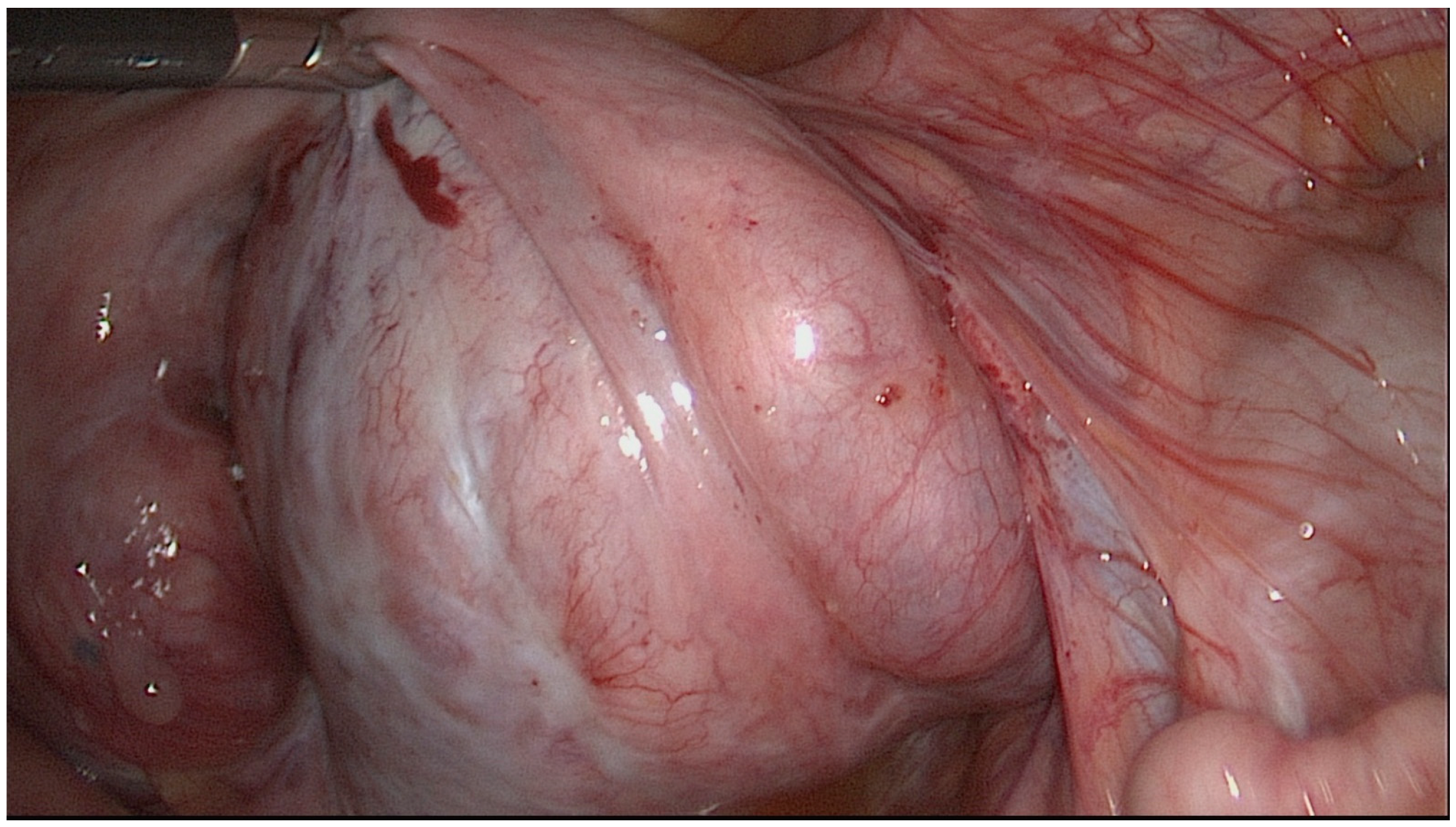 Jcm 11 03278 g001 Jcm 11 03278 g001