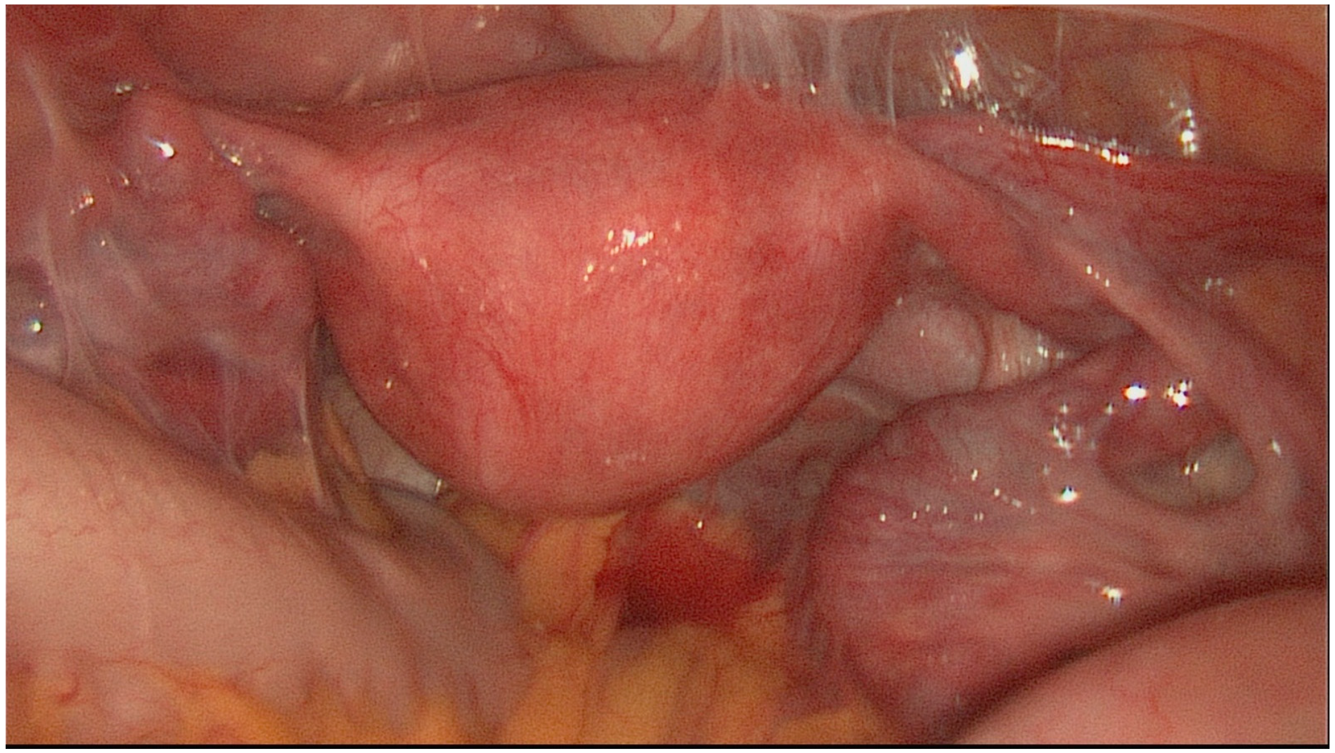 Jcm 11 03278 g003 Jcm 11 03278 g003