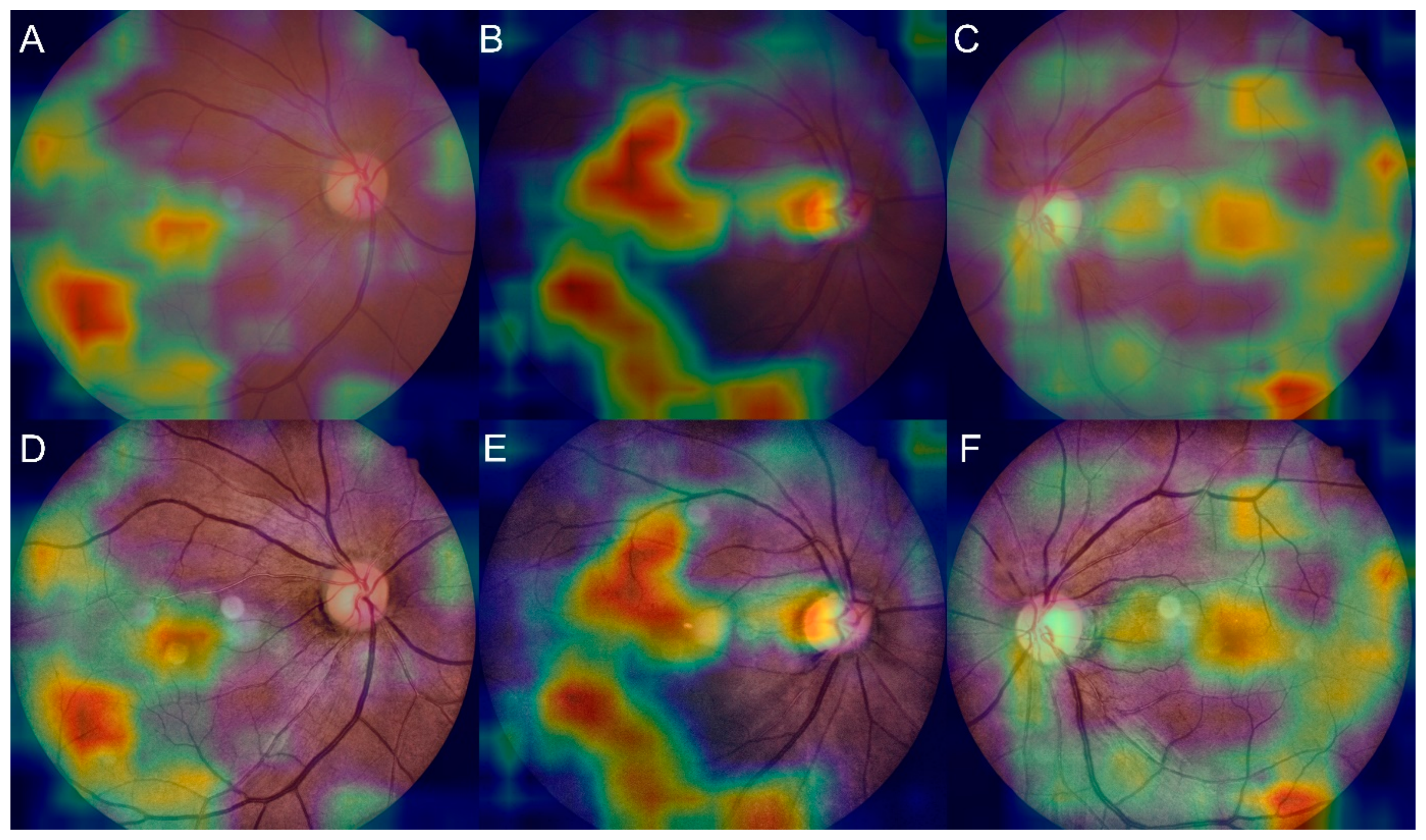 Jcm 11 03309 g005 Jcm 11 03309 g005
