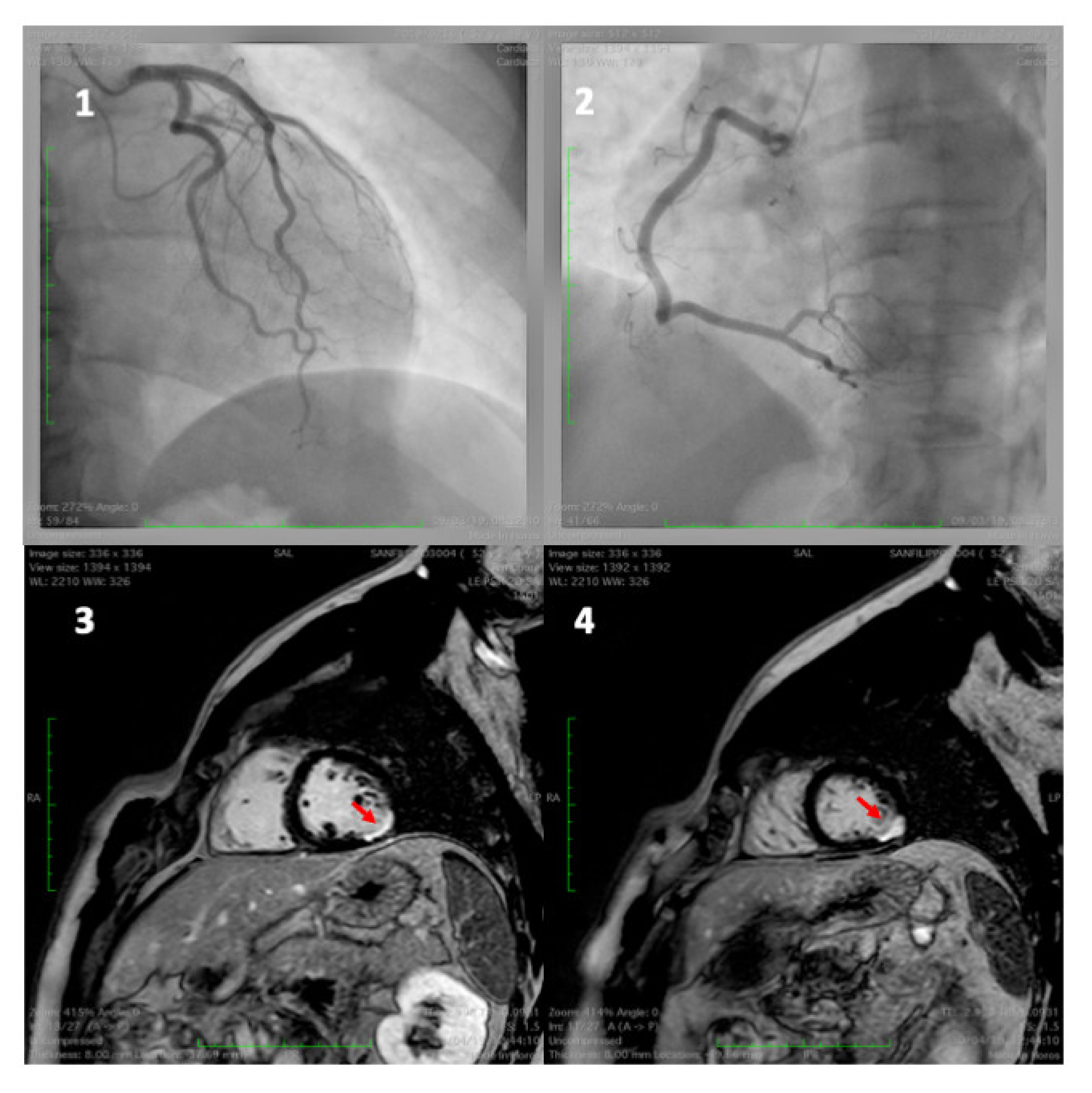 Jcm 11 03353 g002 Jcm 11 03353 g002