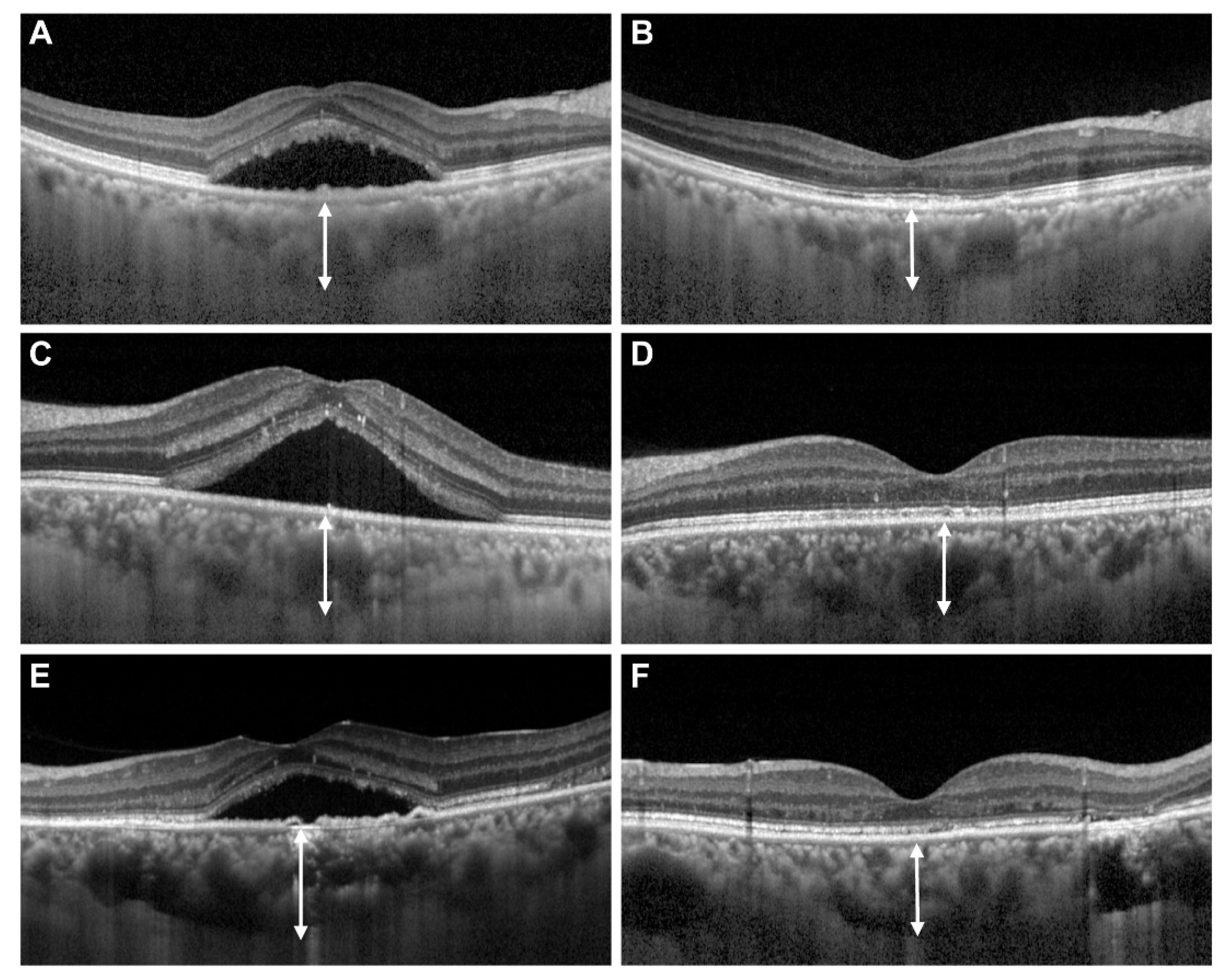 Jcm 11 03375 g001 550