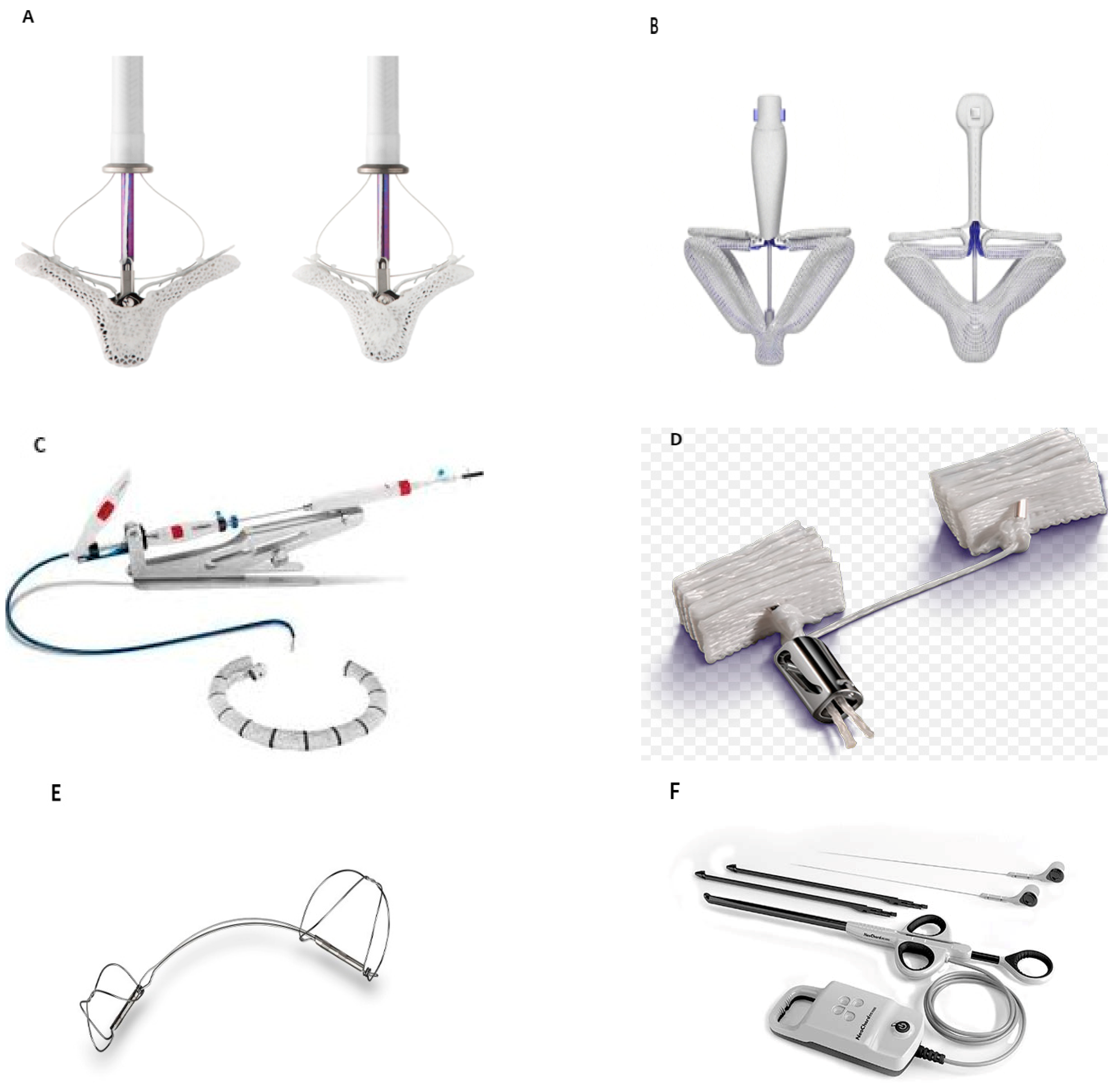 Frontiers | Current Devices in Mitral Valve Replacement and Their Potential  Complications